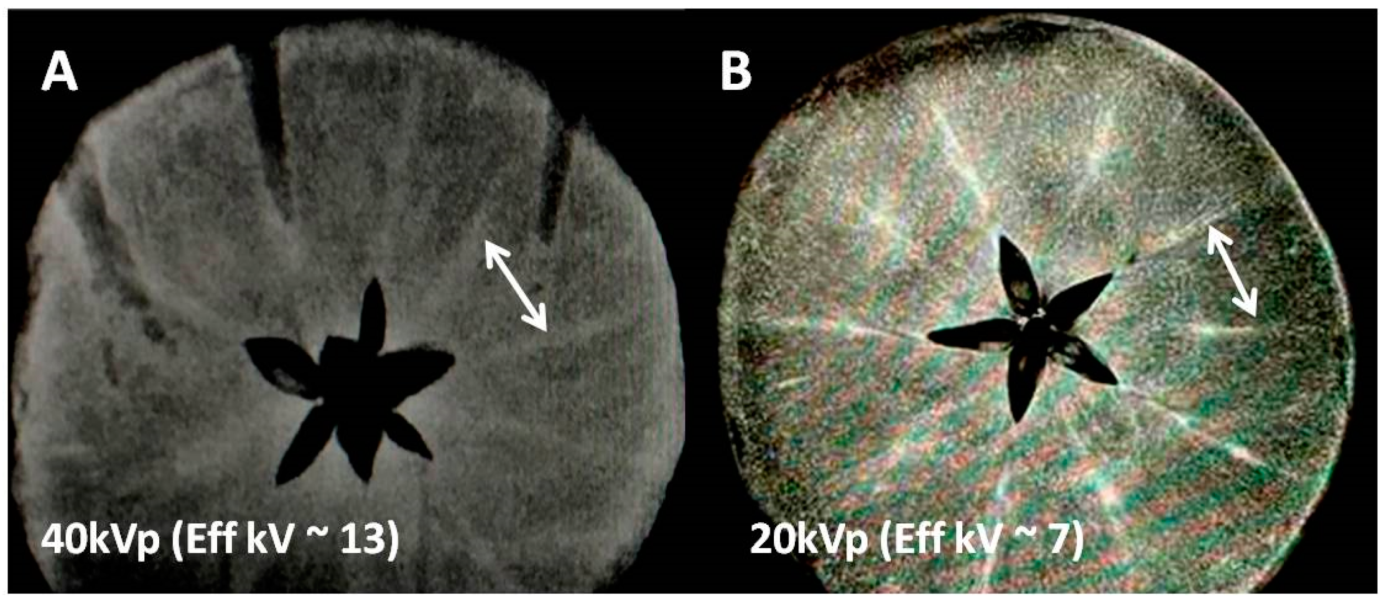 Tomography 08 00114 g001