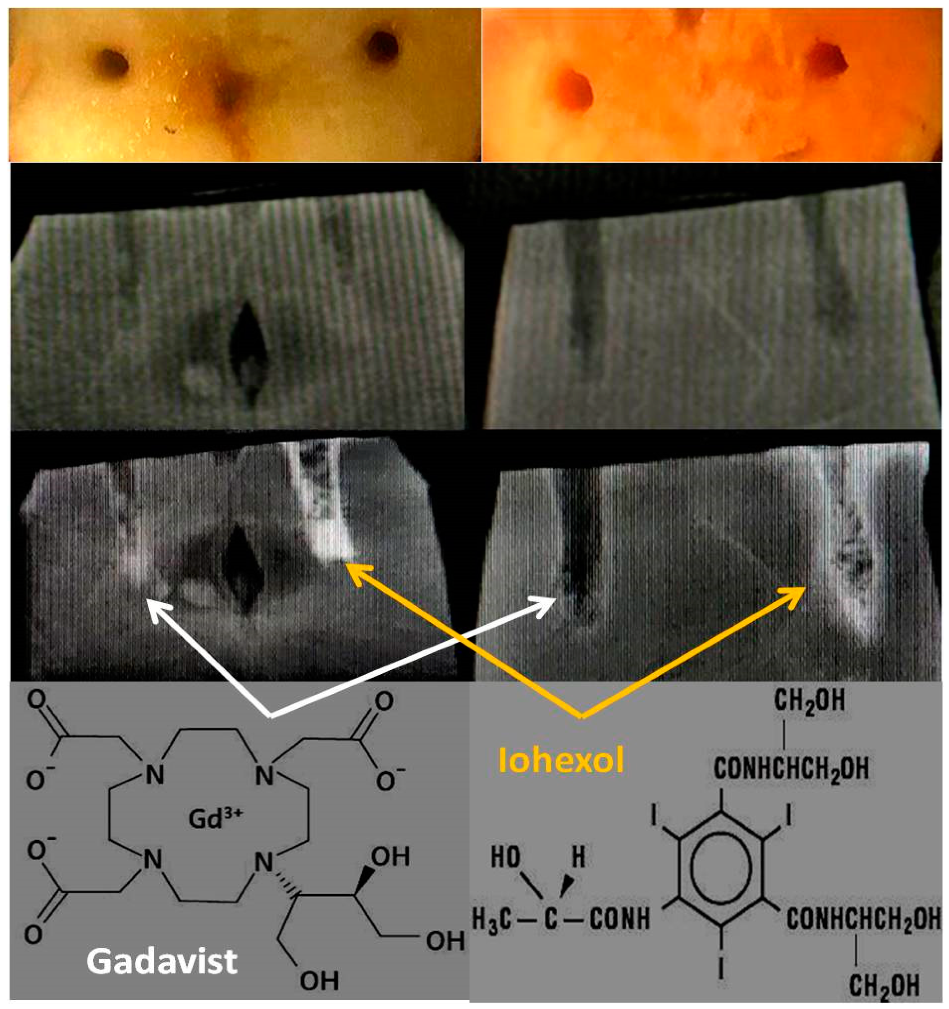Tomography 08 00114 g002