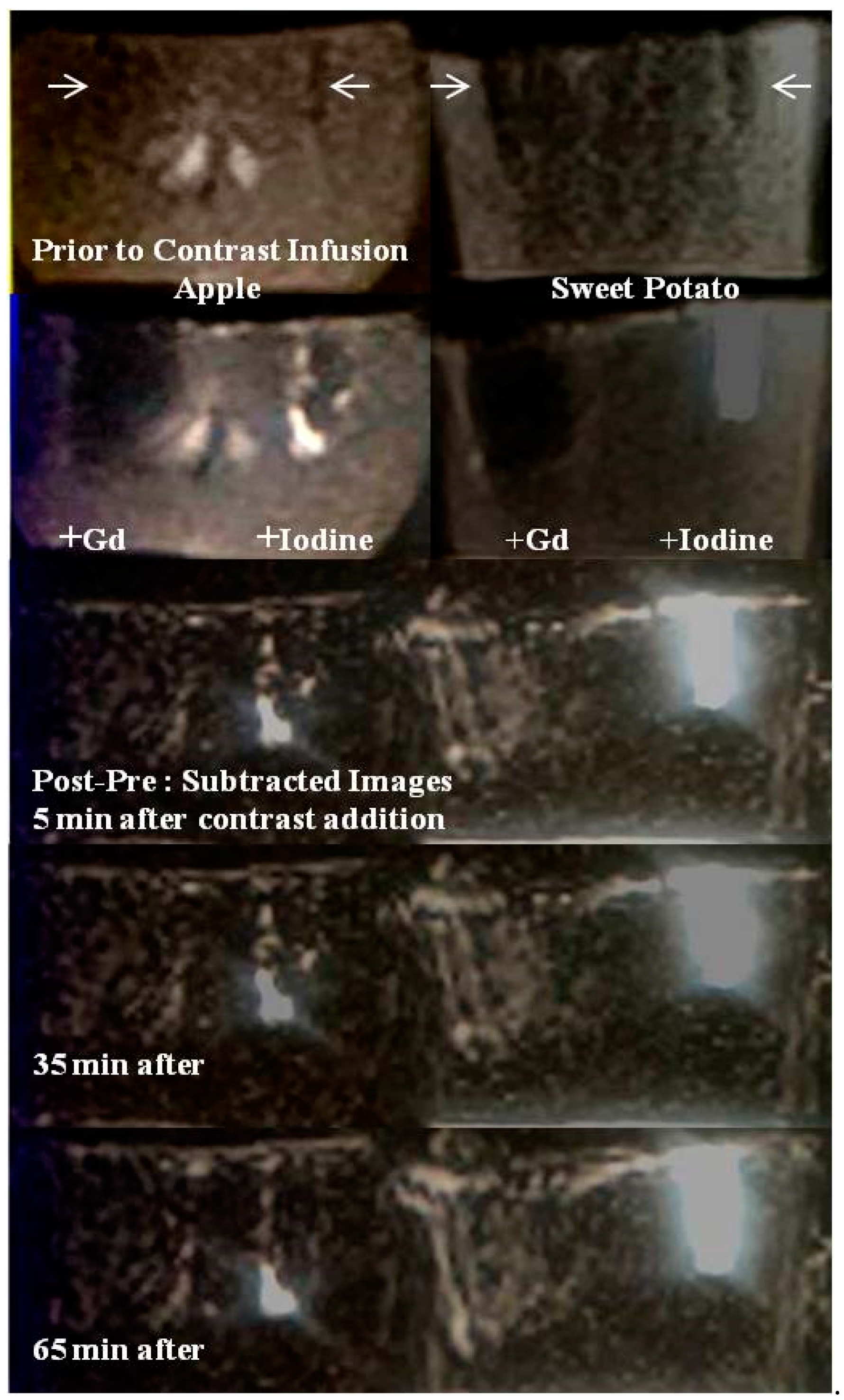 Tomography 08 00114 g003