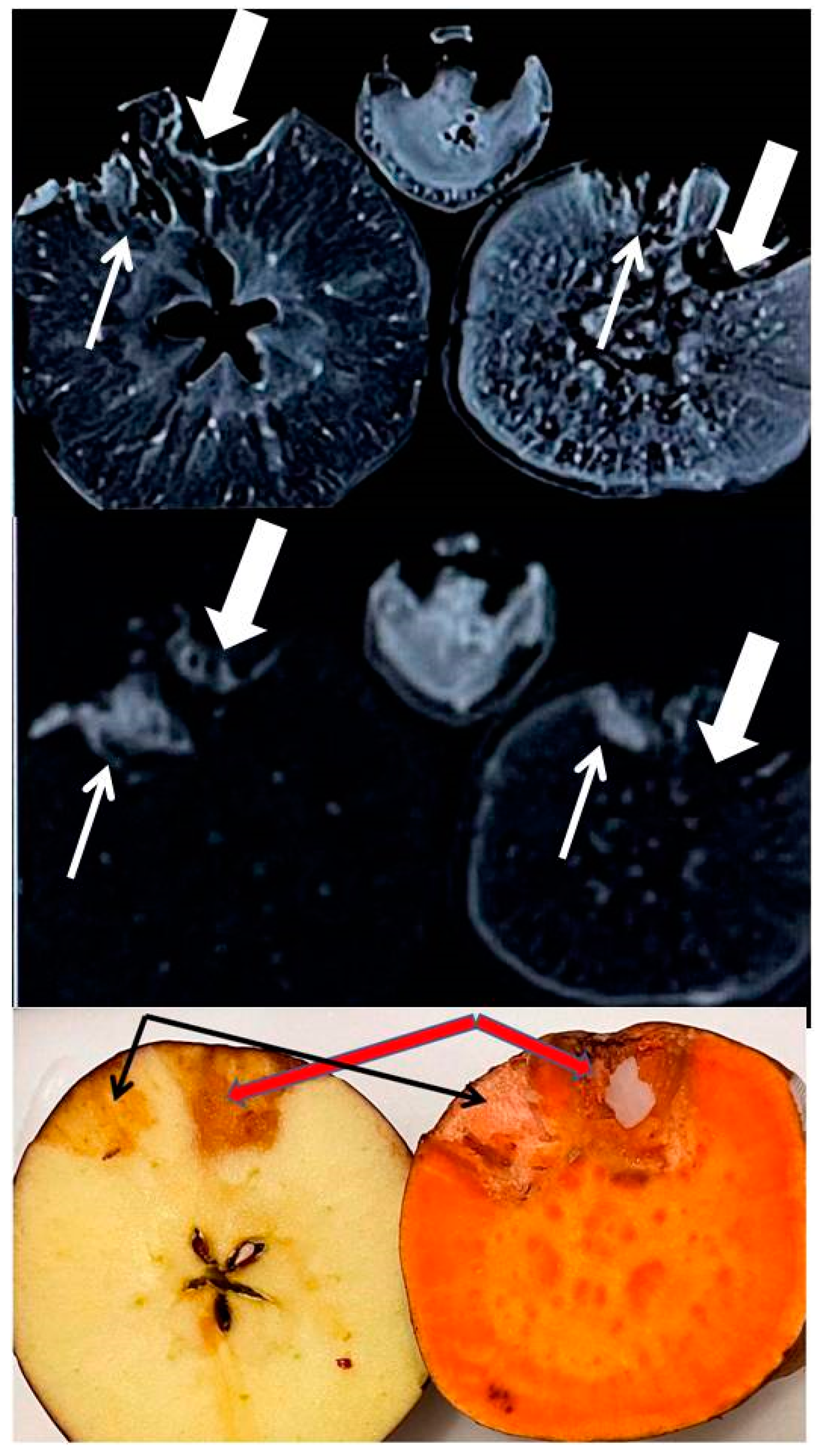 Tomography 08 00114 g004