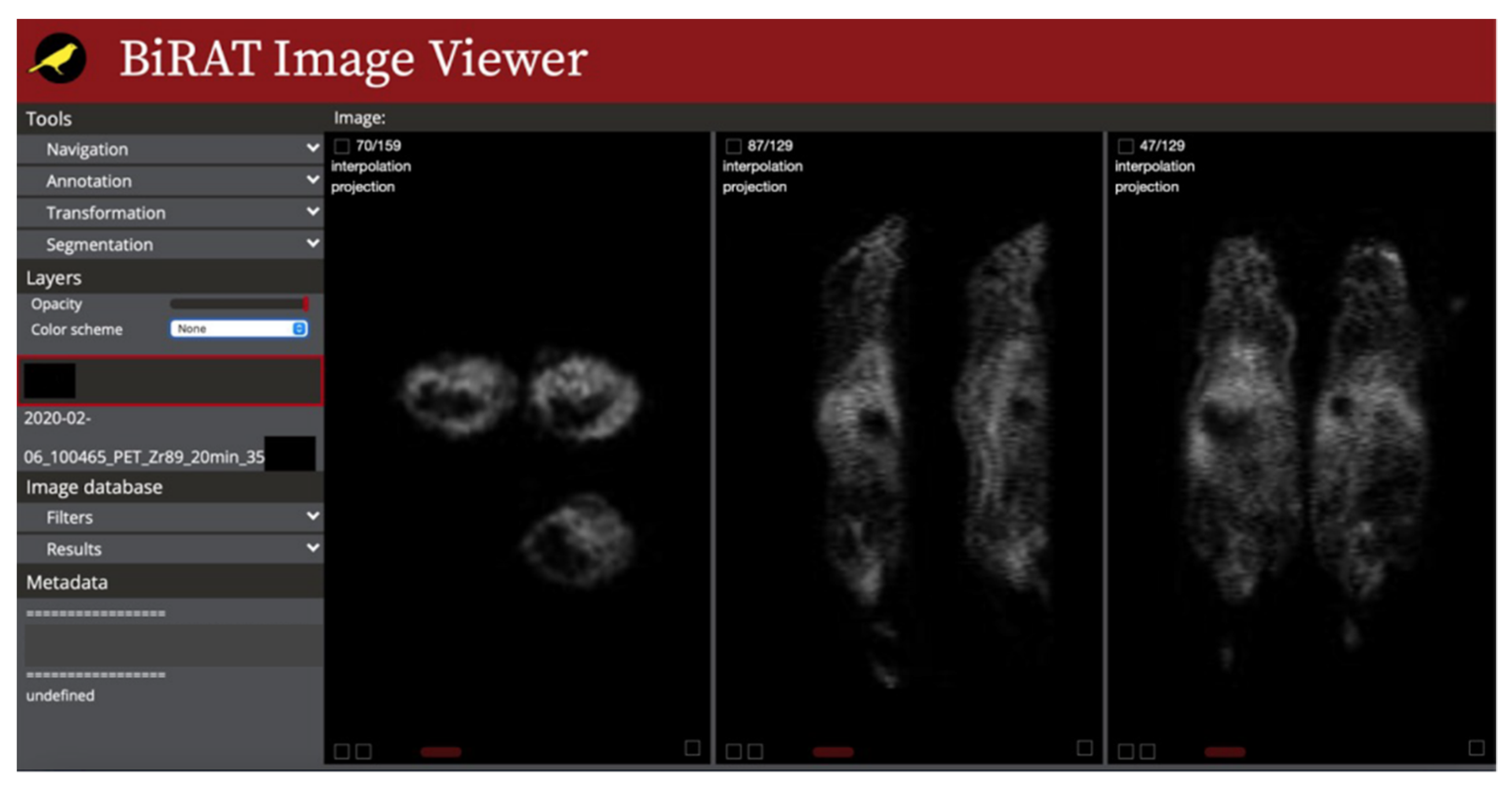 Tomography 08 00117 g005