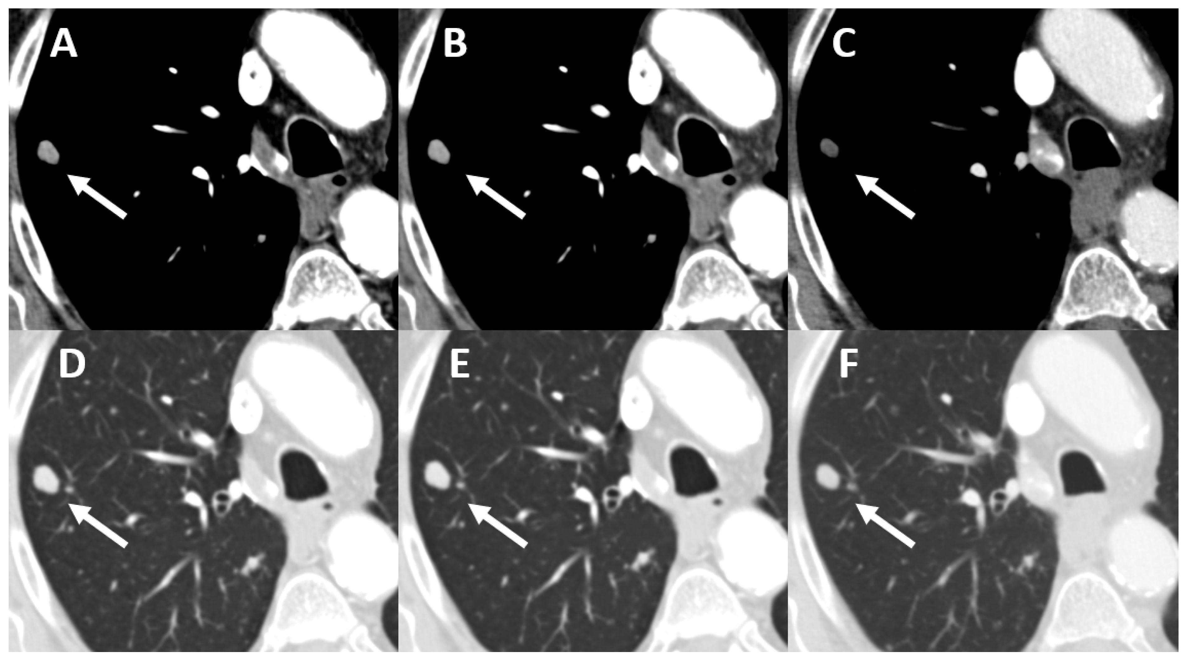 Tomography 08 00119 g001