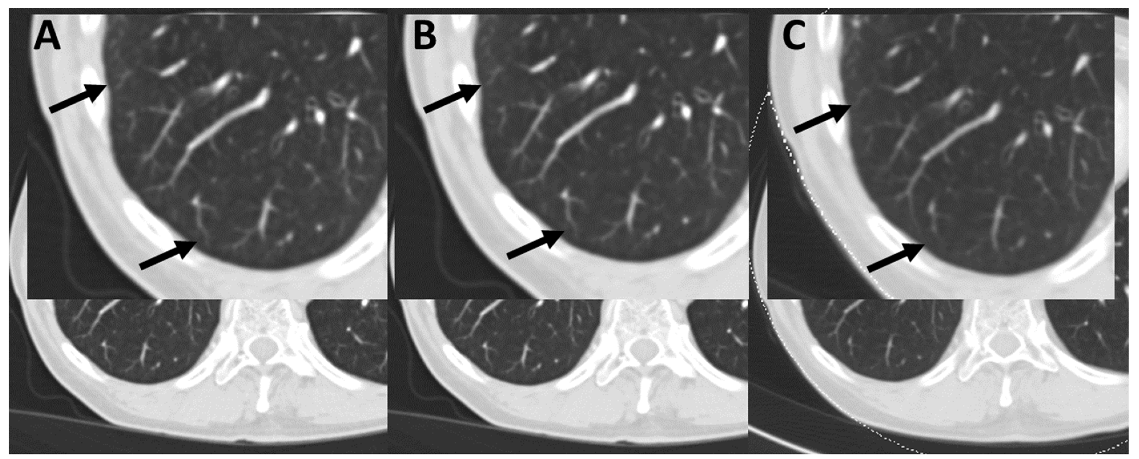 Tomography 08 00119 g003