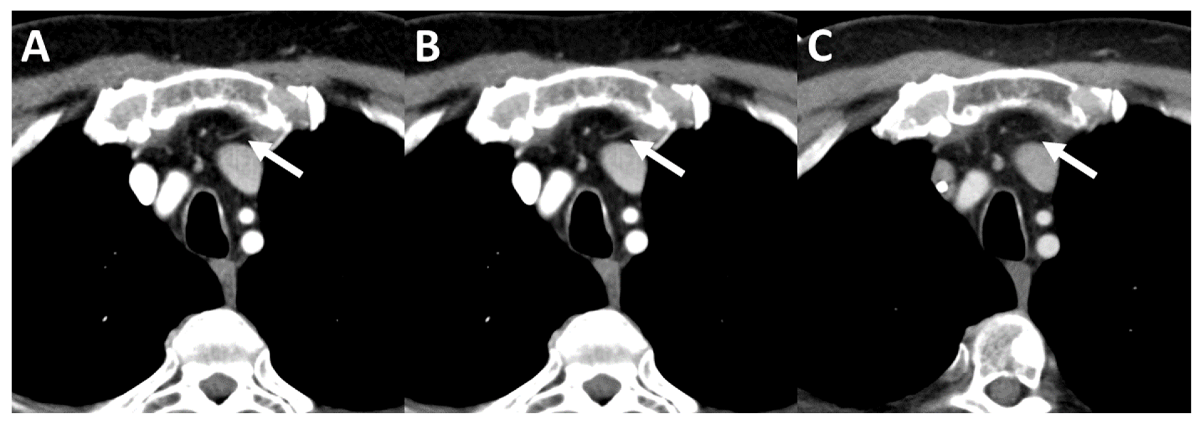 Tomography 08 00119 g004