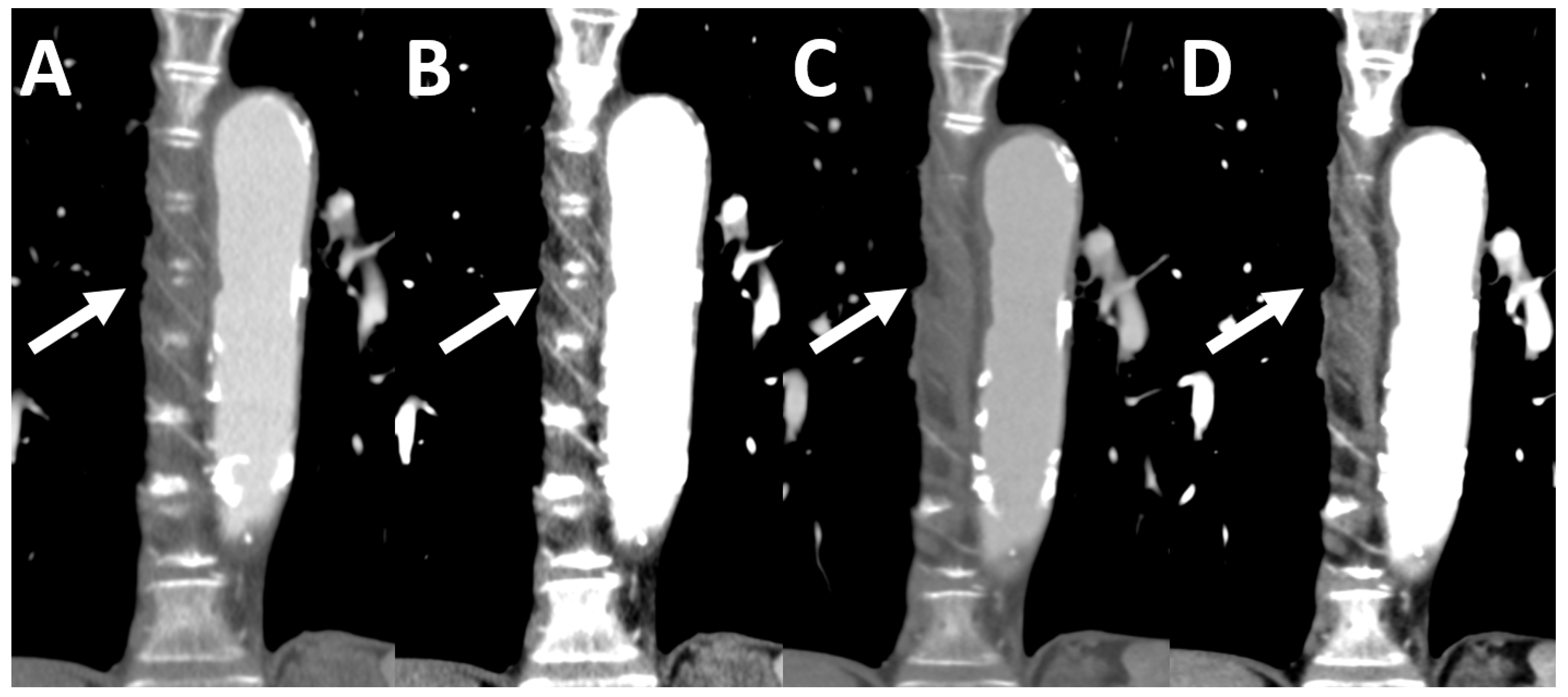 Tomography 08 00119 g005