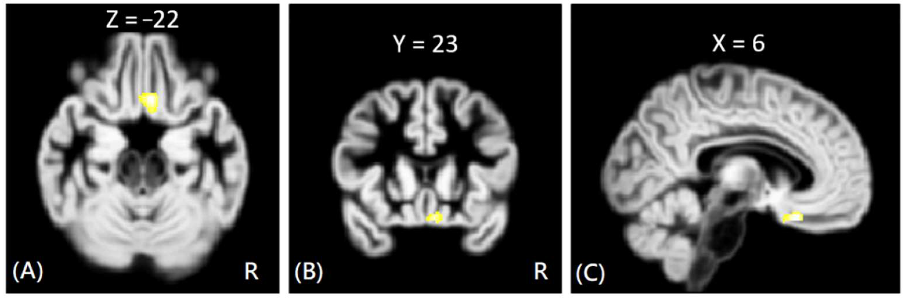Tomography 08 00121 g003 550
