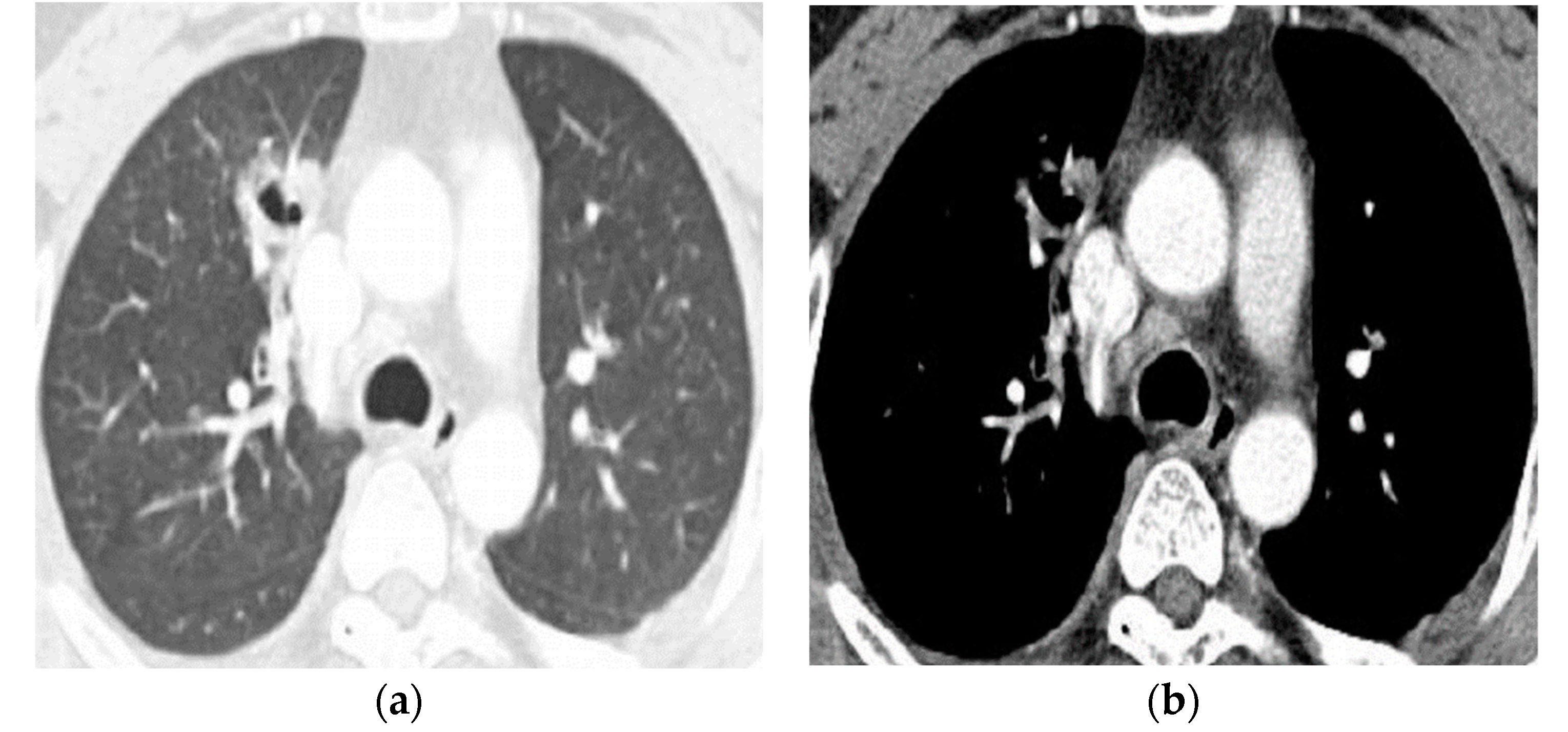 Tomography 08 00122 g004a Tomography 08 00122 g004a