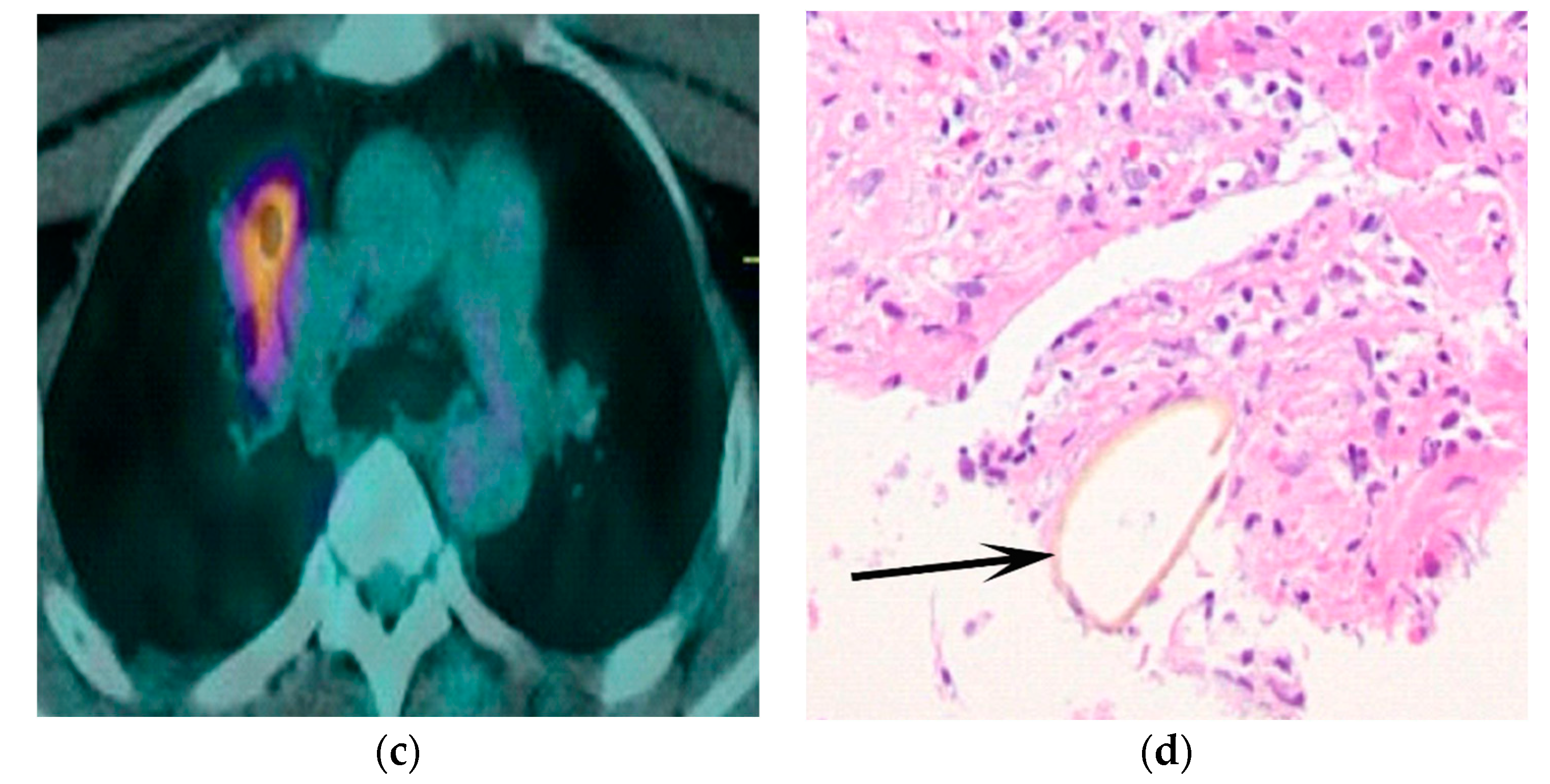 Tomography 08 00122 g004b Tomography 08 00122 g004b