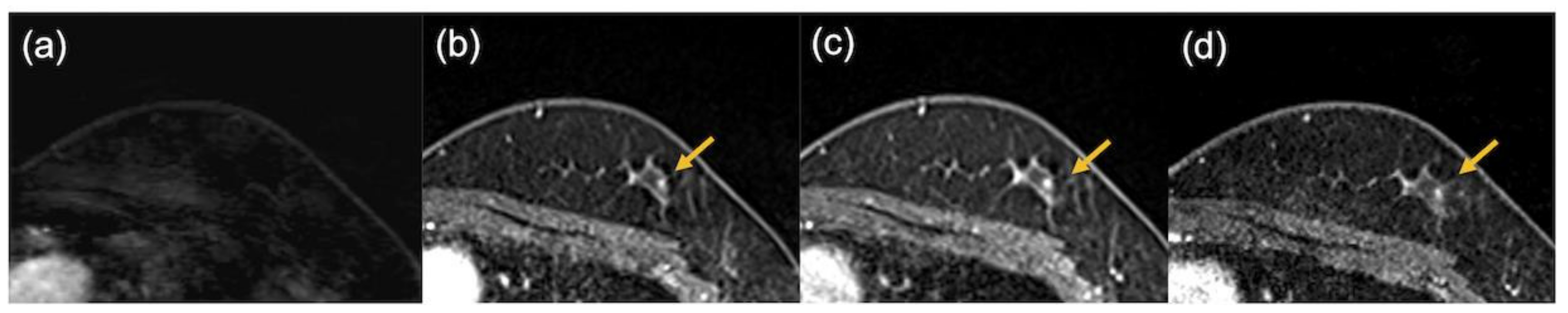 Tomography 08 00125 g007