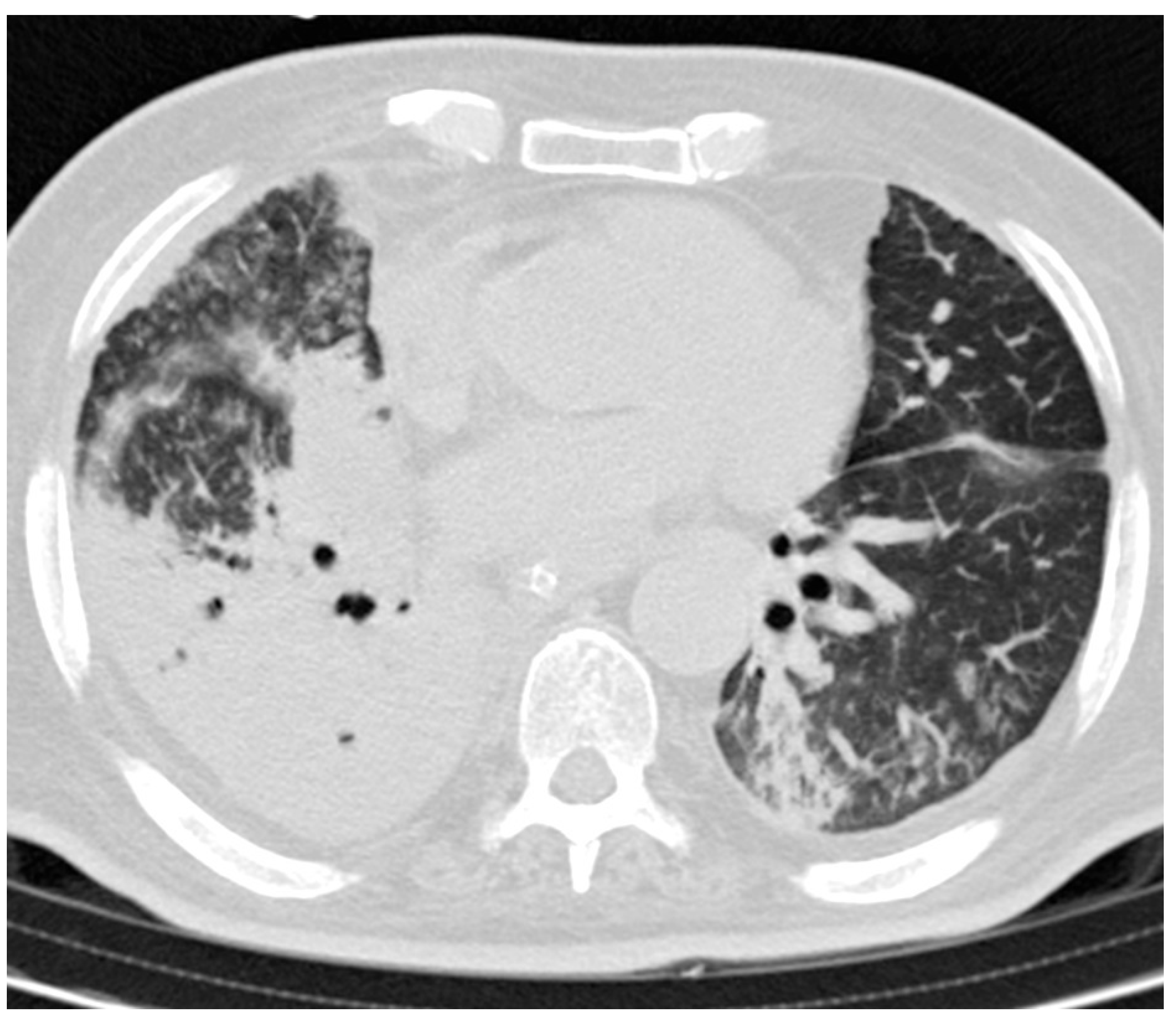 Tomography 08 00126 g002 Tomography 08 00126 g002