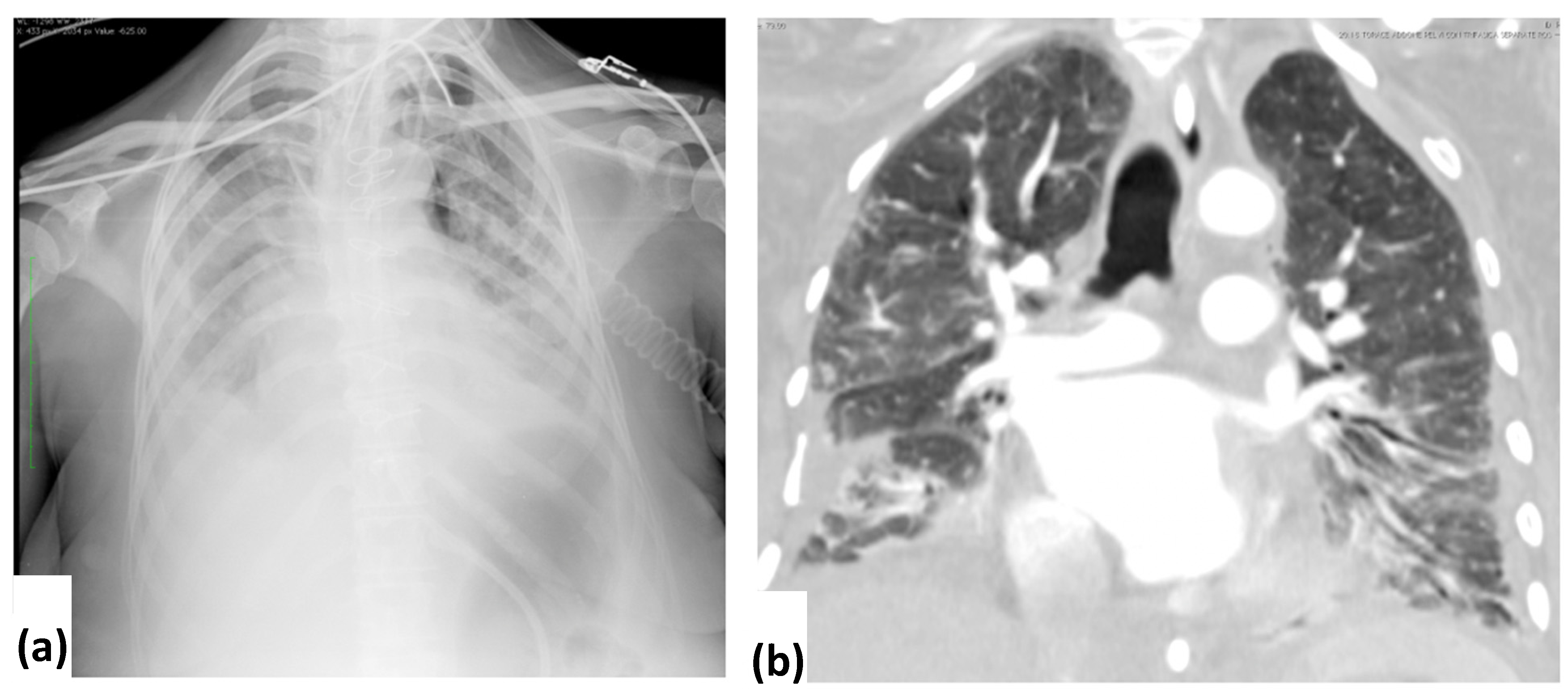 Tomography 08 00126 g003 Tomography 08 00126 g003