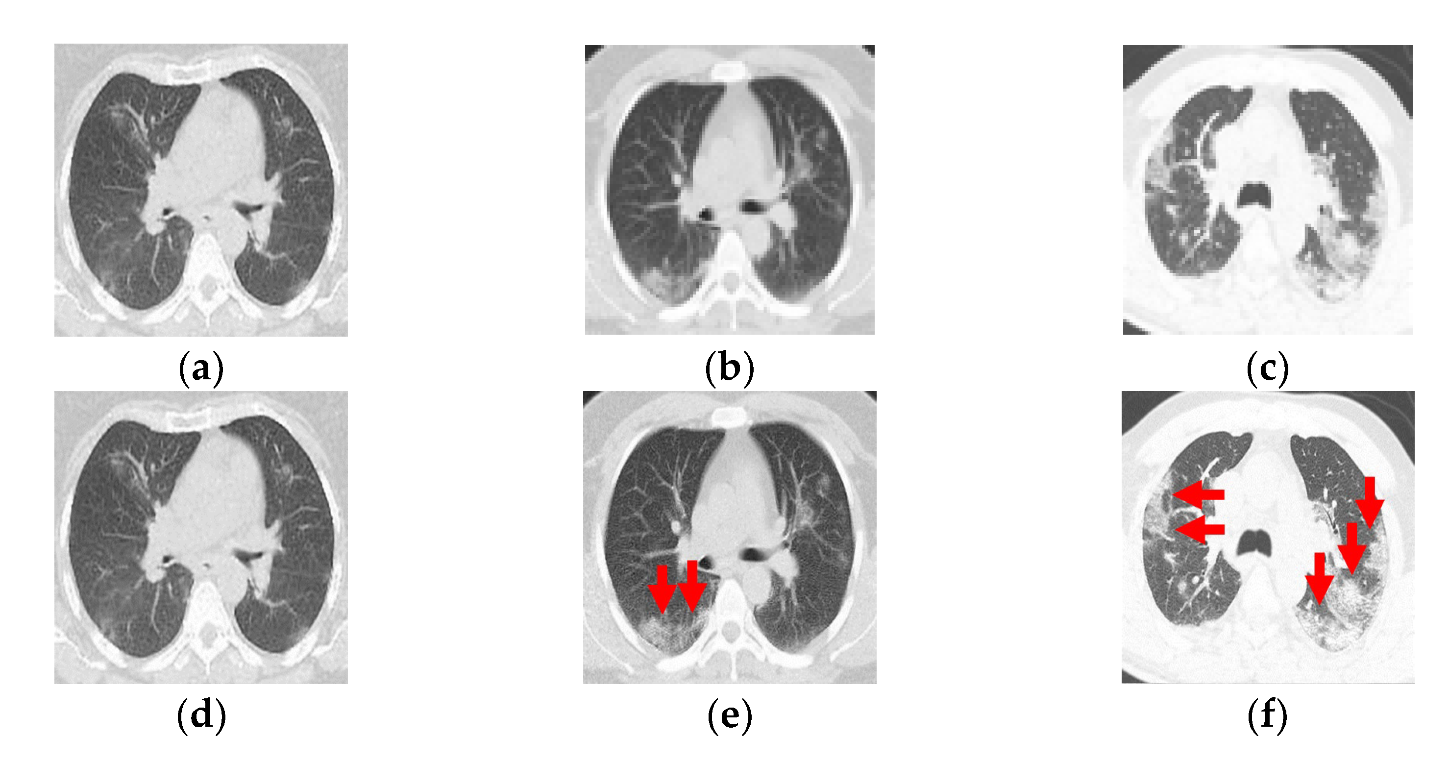 Tomography 08 00134 g001