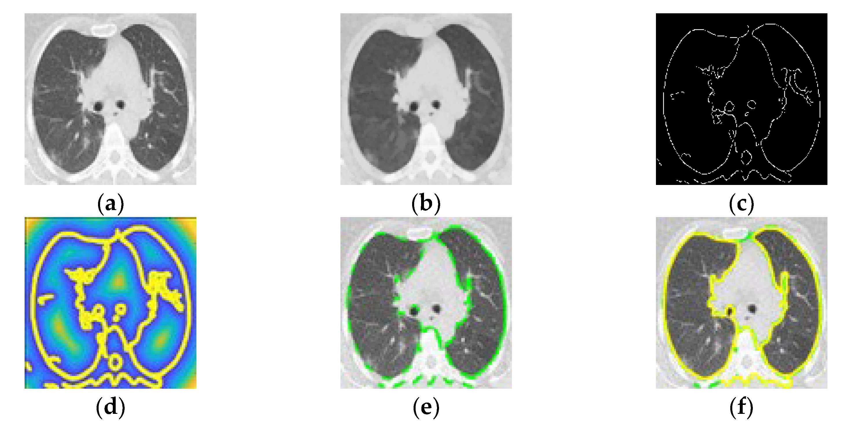 Tomography 08 00134 g003