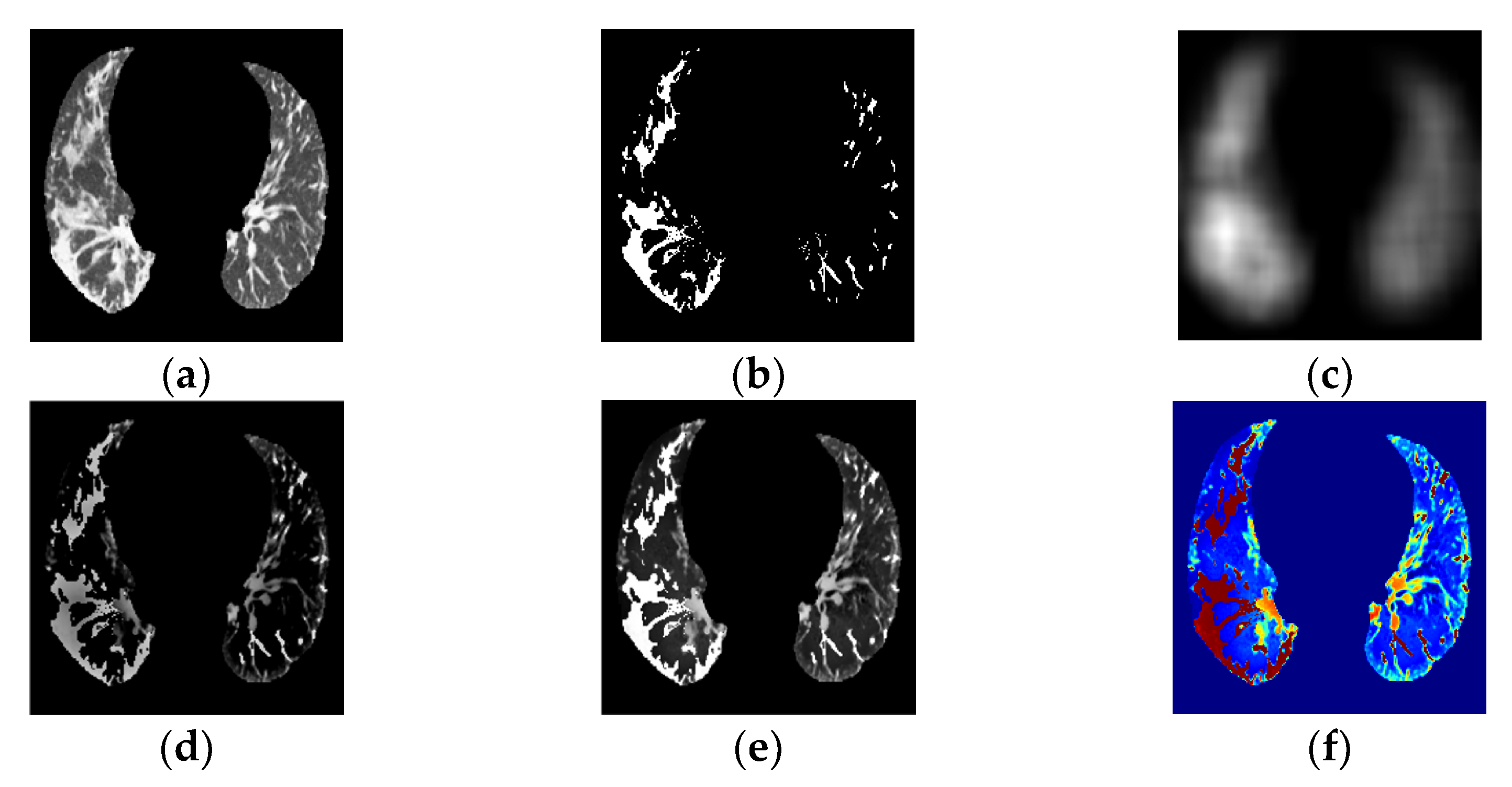 Tomography 08 00134 g004