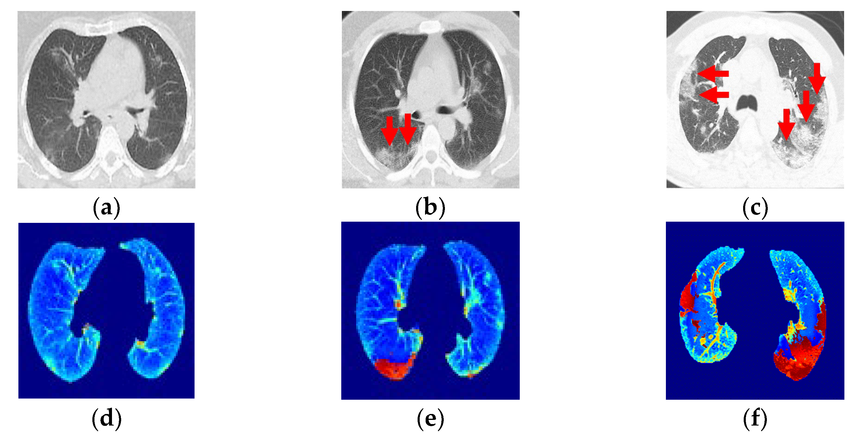 Tomography 08 00134 g005