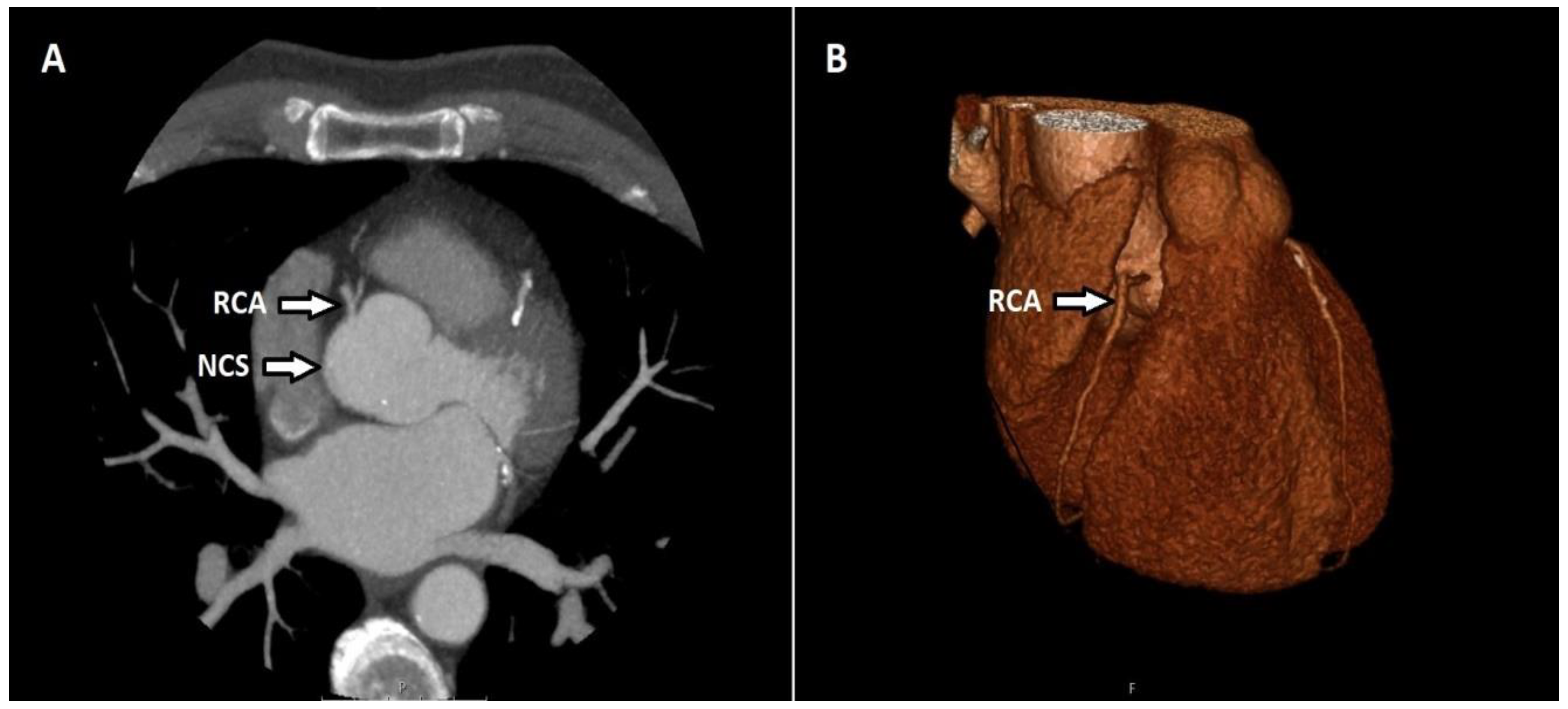 Tomography 08 00135 g002