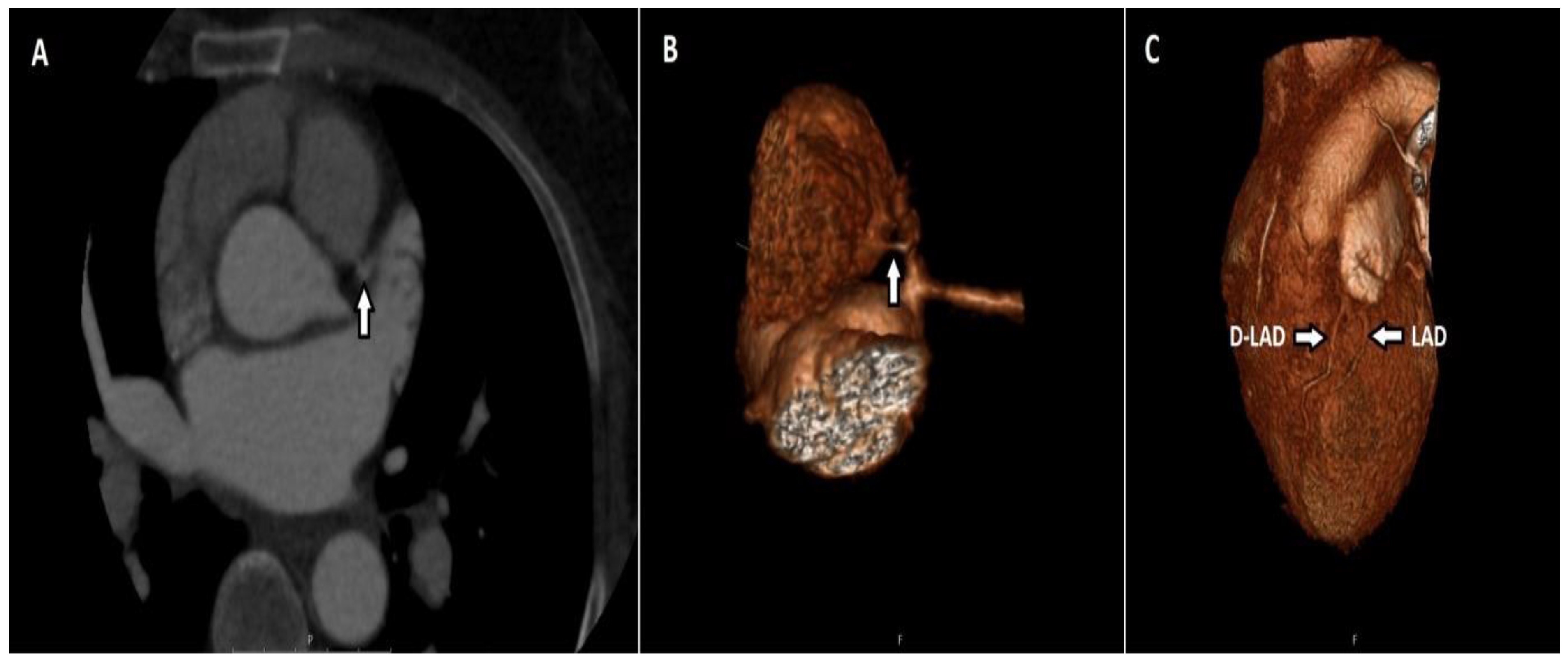 Tomography 08 00135 g005