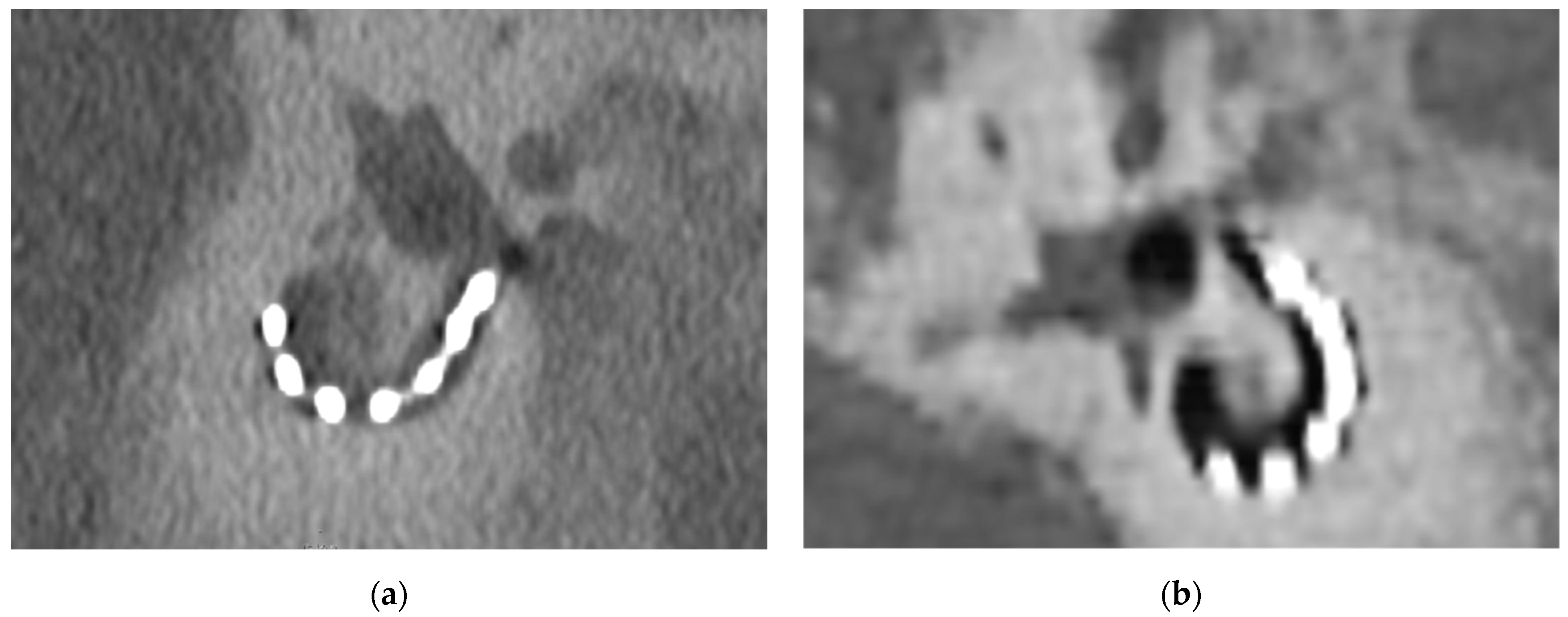 Tomography 08 00136 g002 550