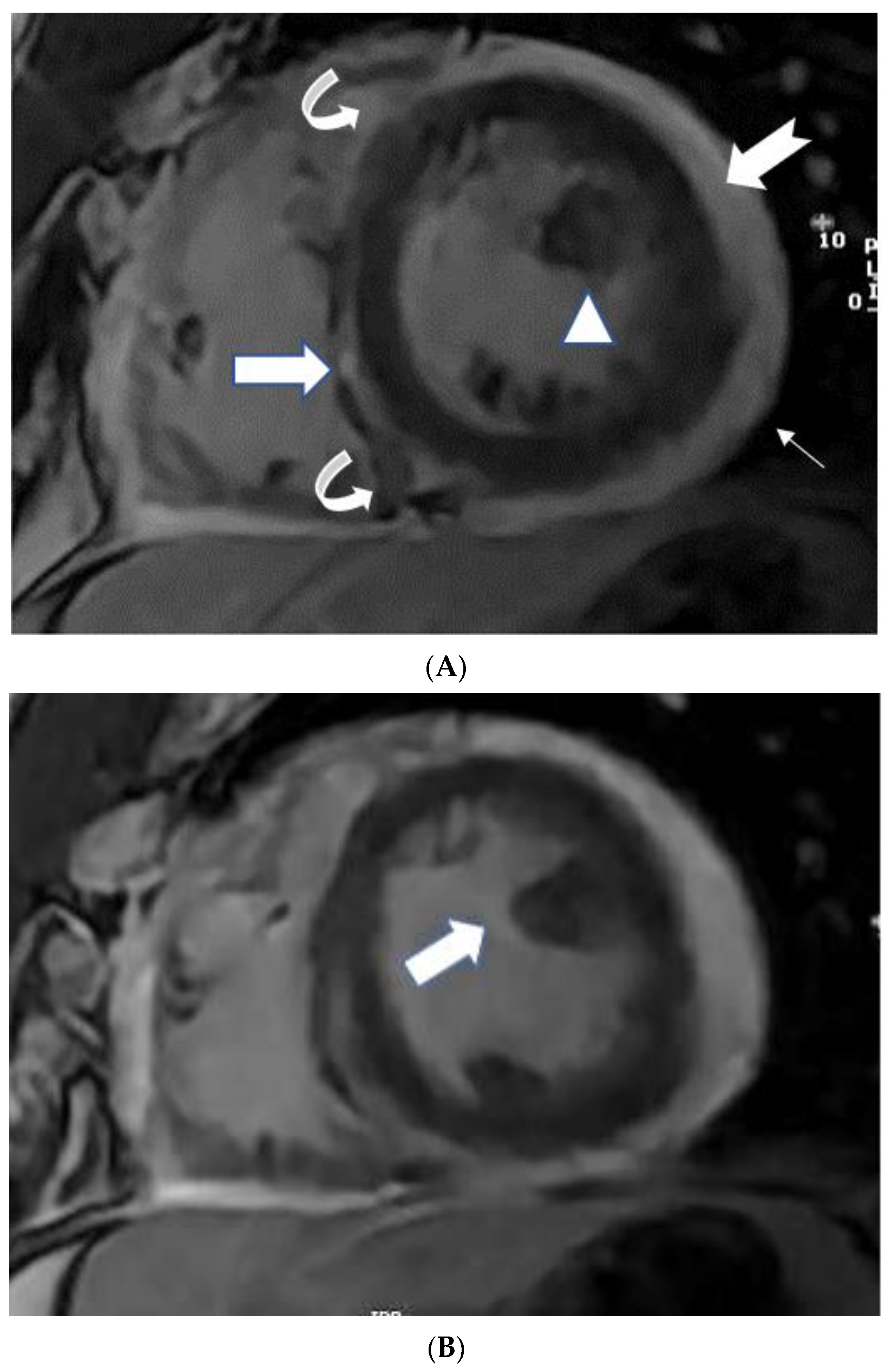 Tomography 08 00137 g002a