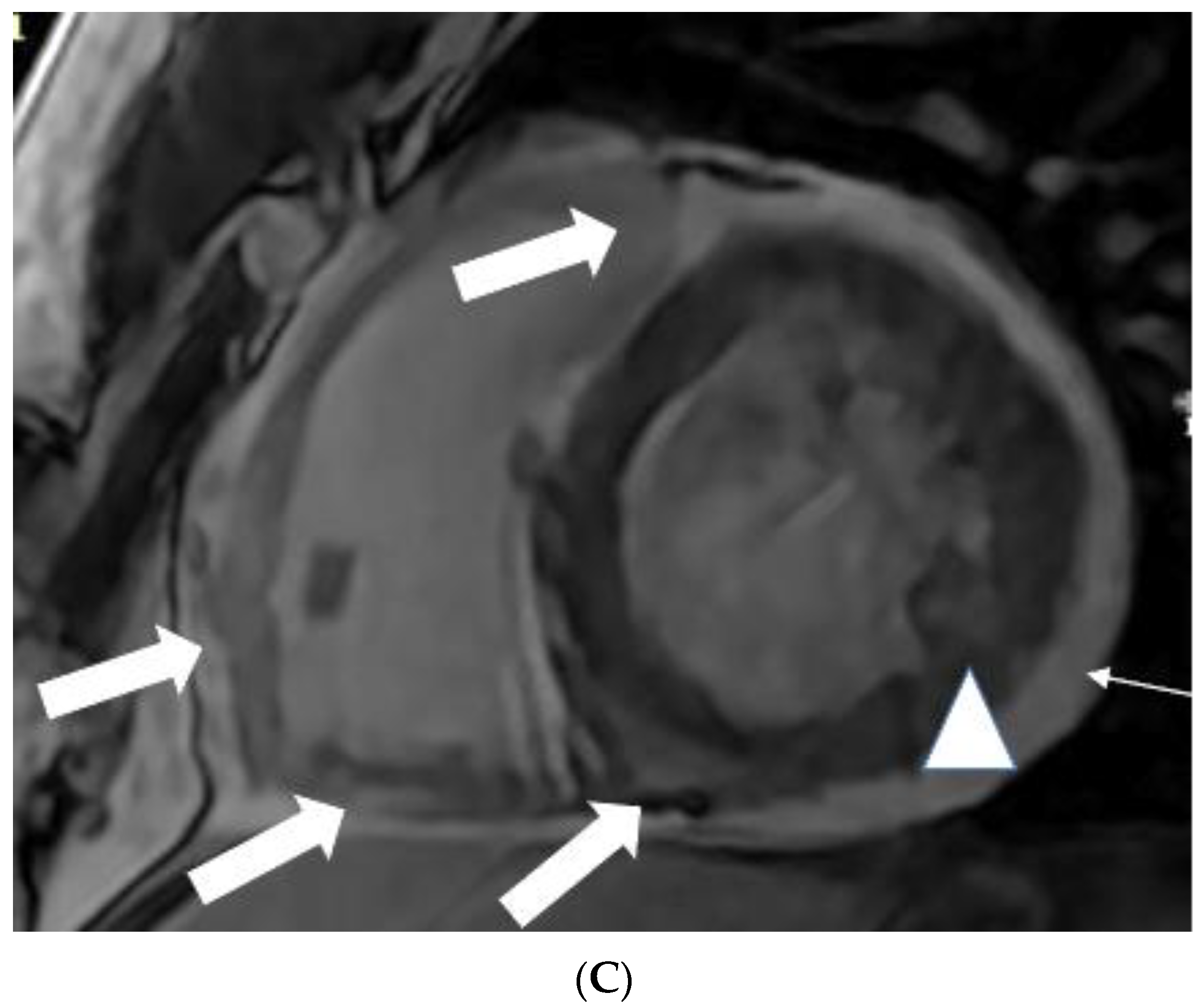 Tomography 08 00137 g002b