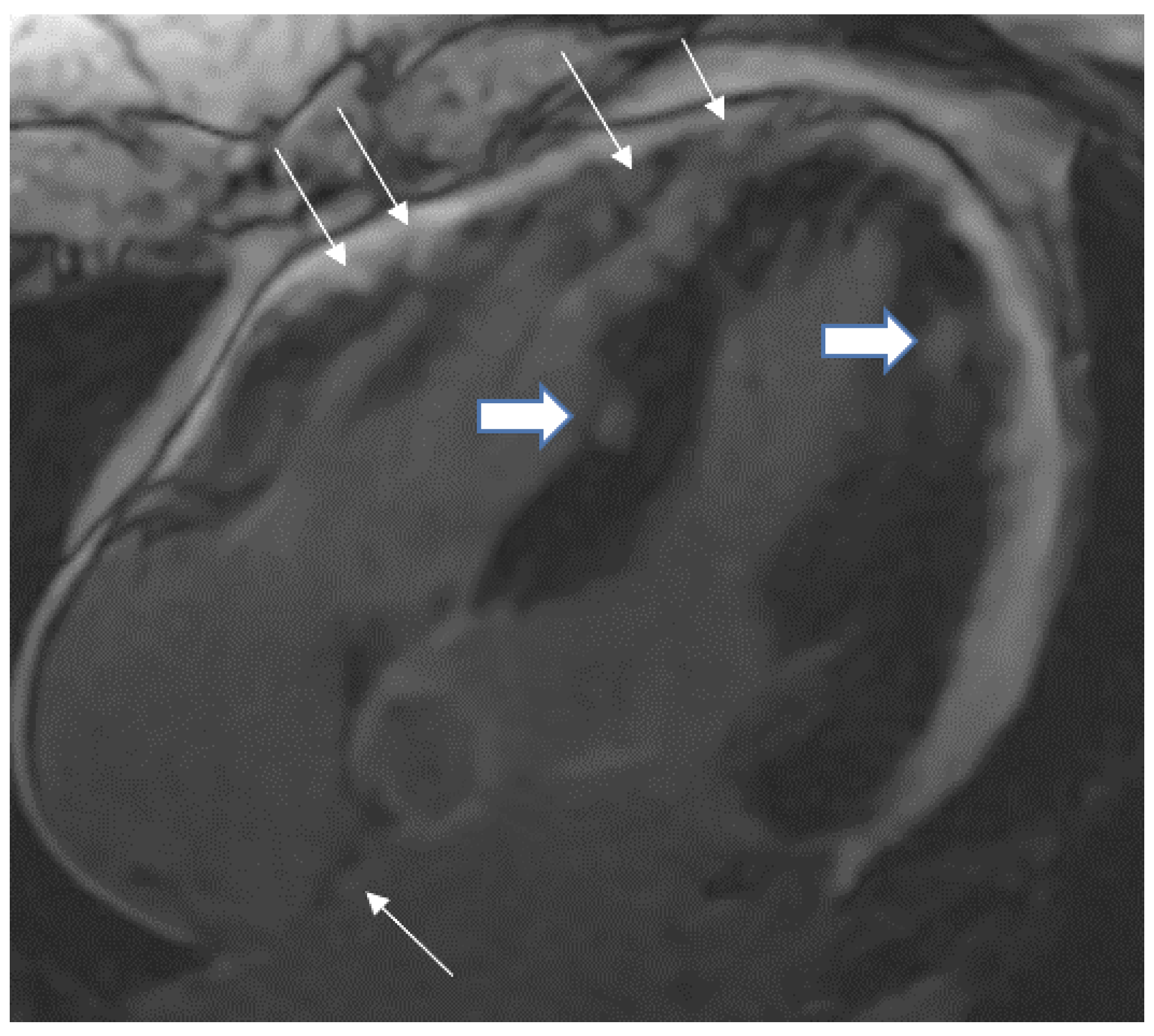 Tomography 08 00137 g003