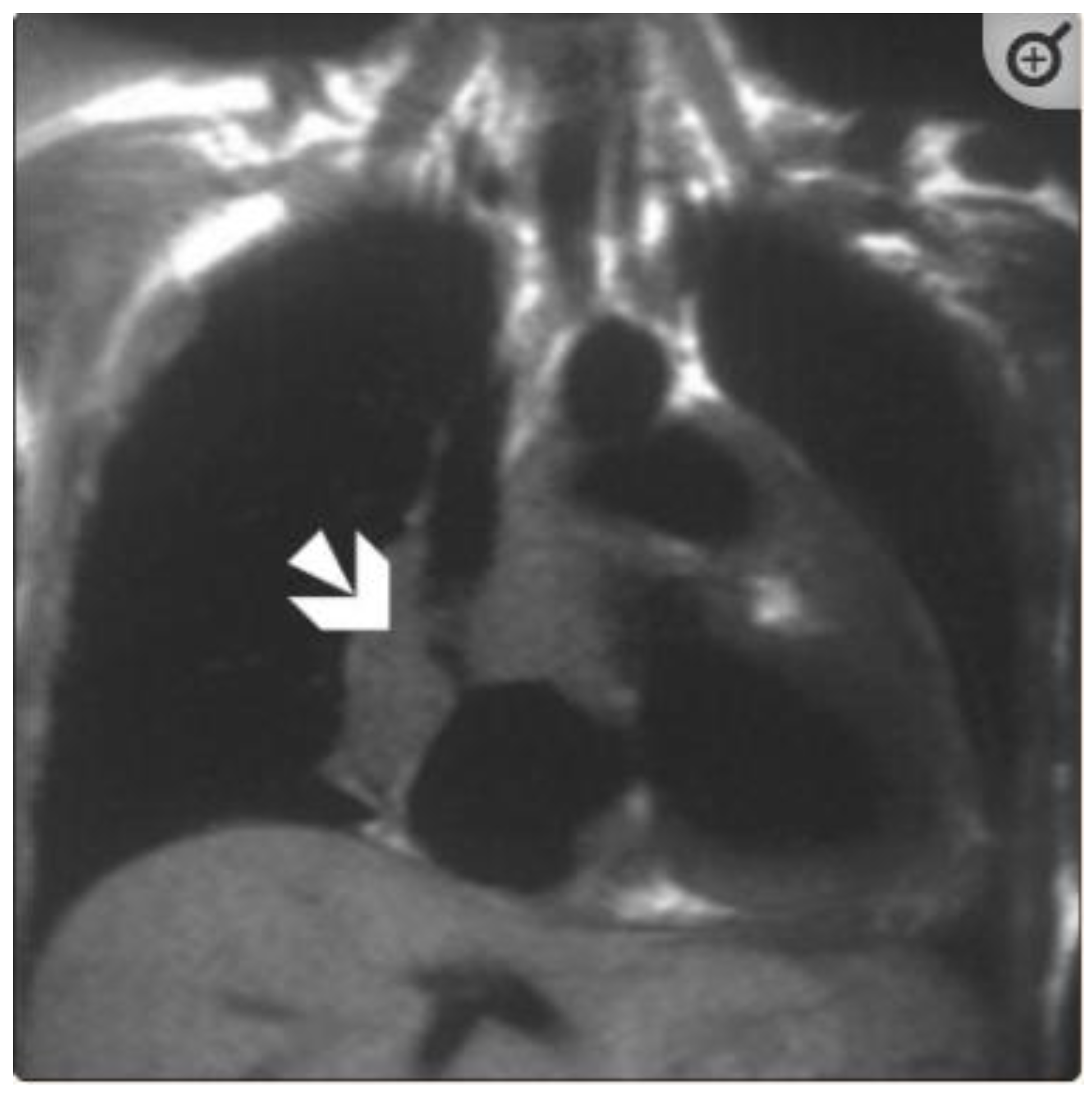Tomography 08 00137 g005