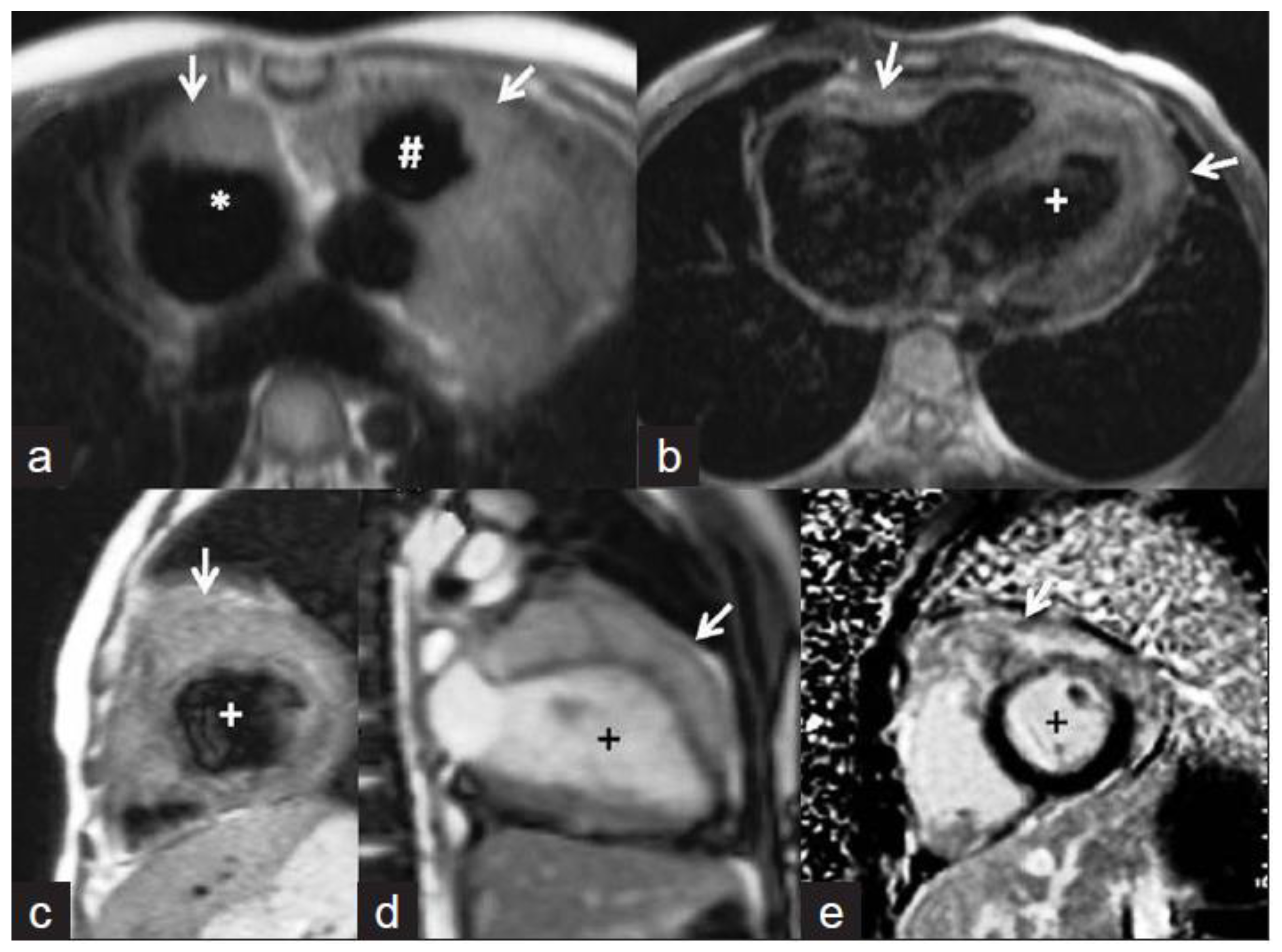 Tomography 08 00137 g006