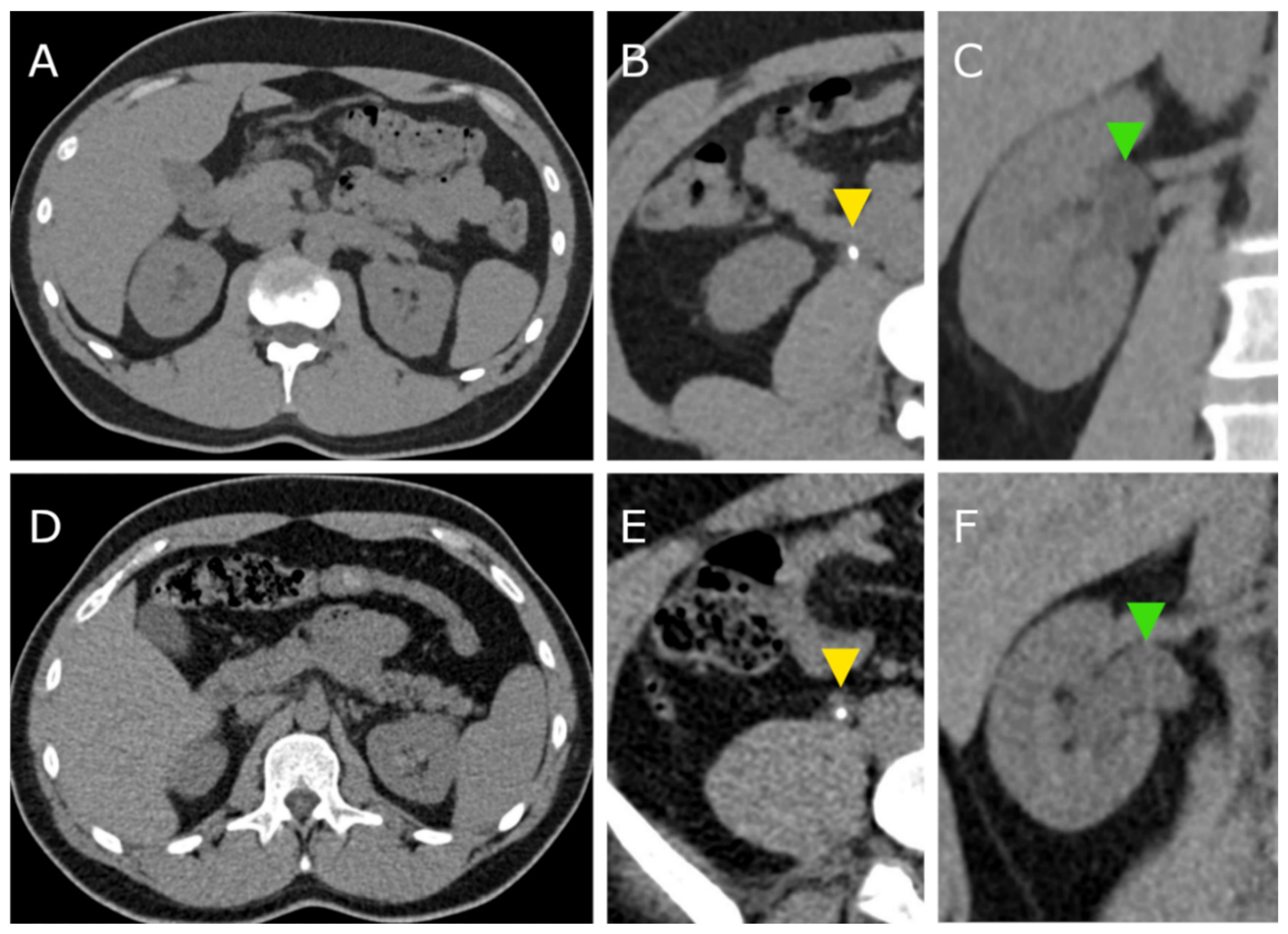 Tomography 08 00138 g001