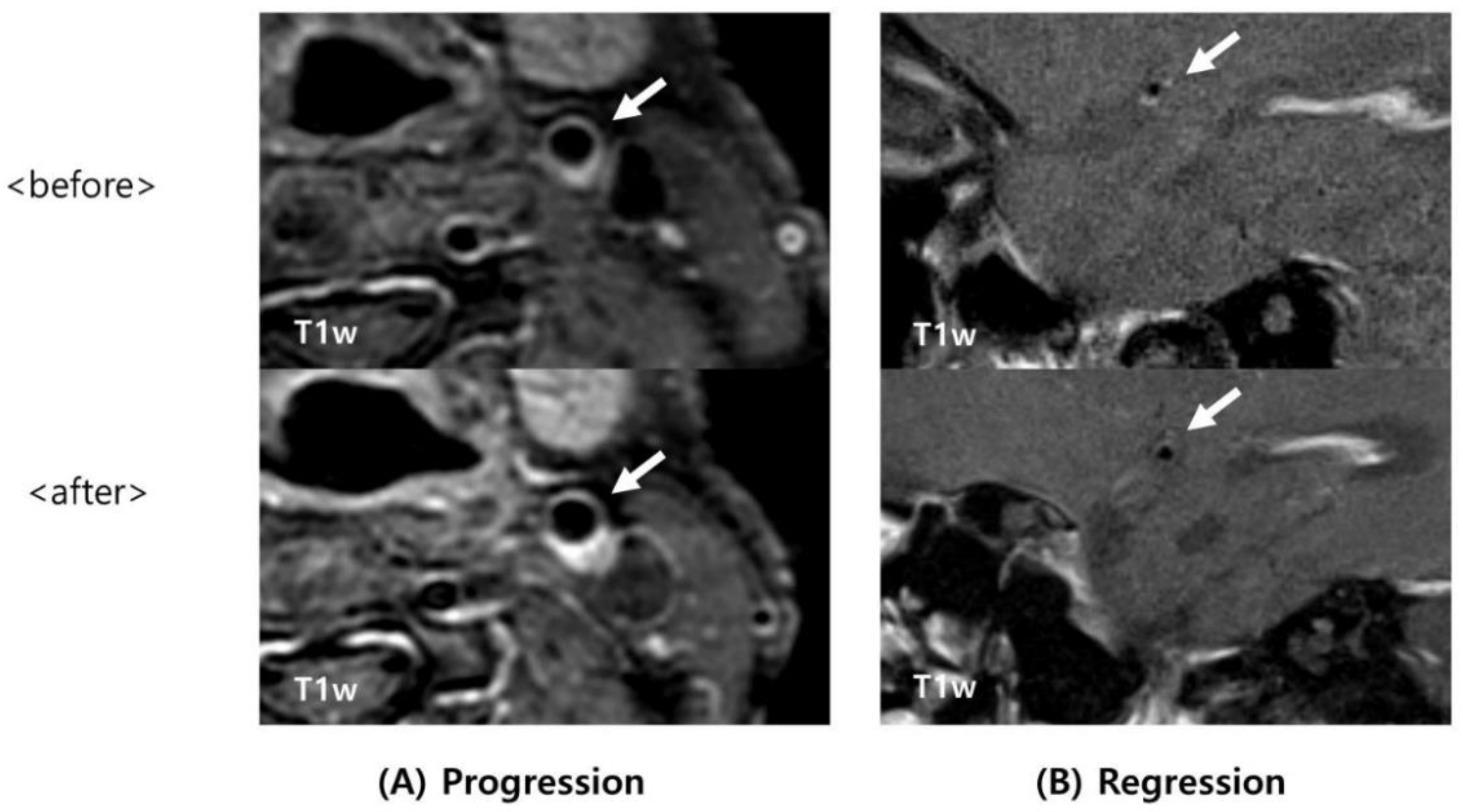 Tomography 08 00141 g002 550