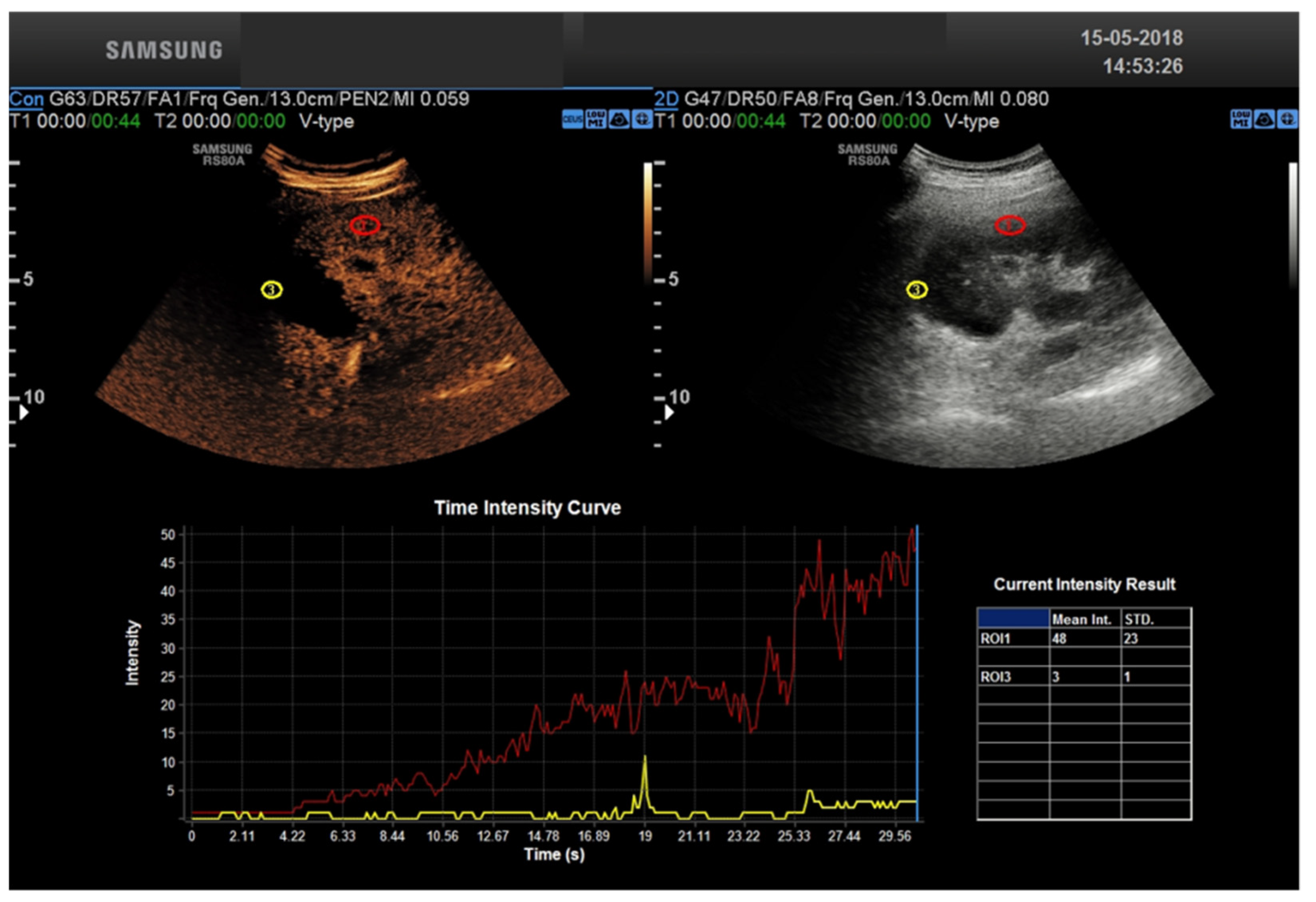 Tomography 08 00143 g003