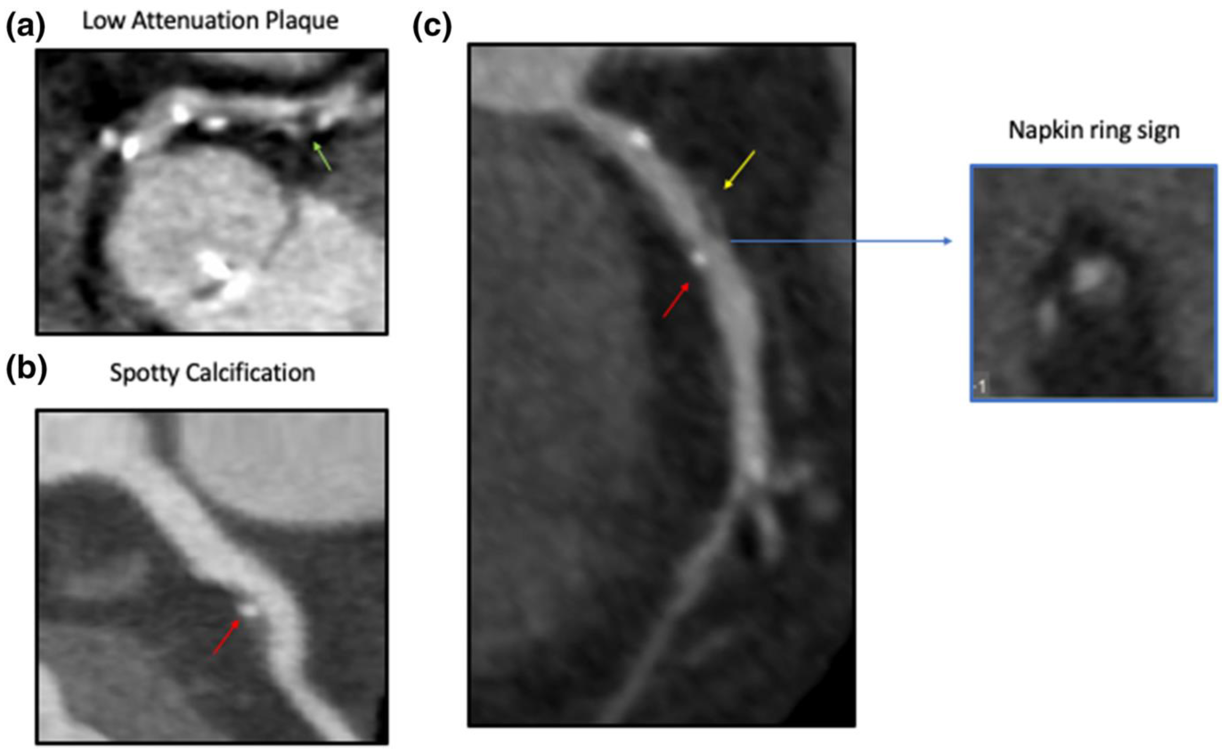 Tomography 08 00147 g003