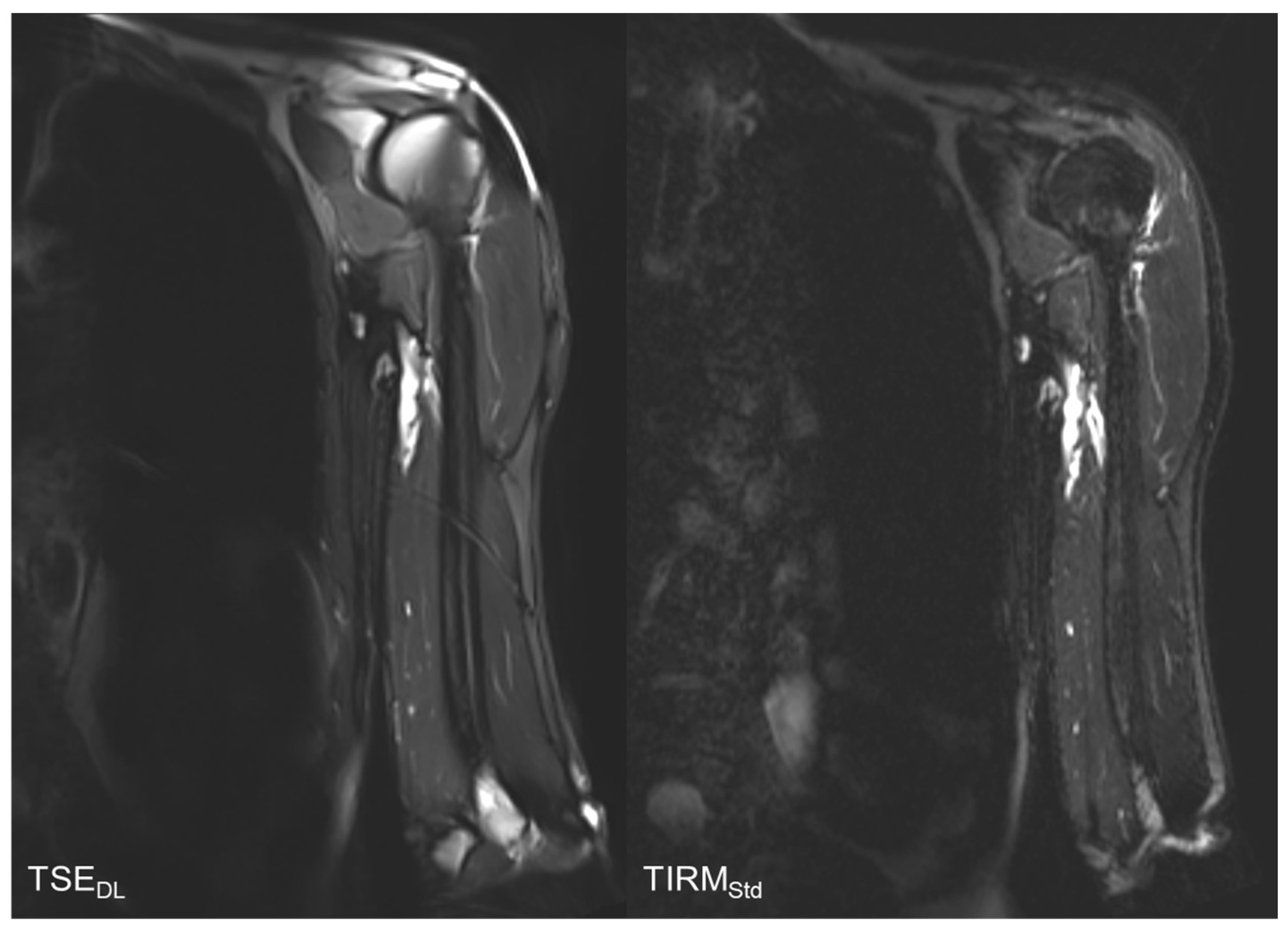 Tomography 08 00148 g002