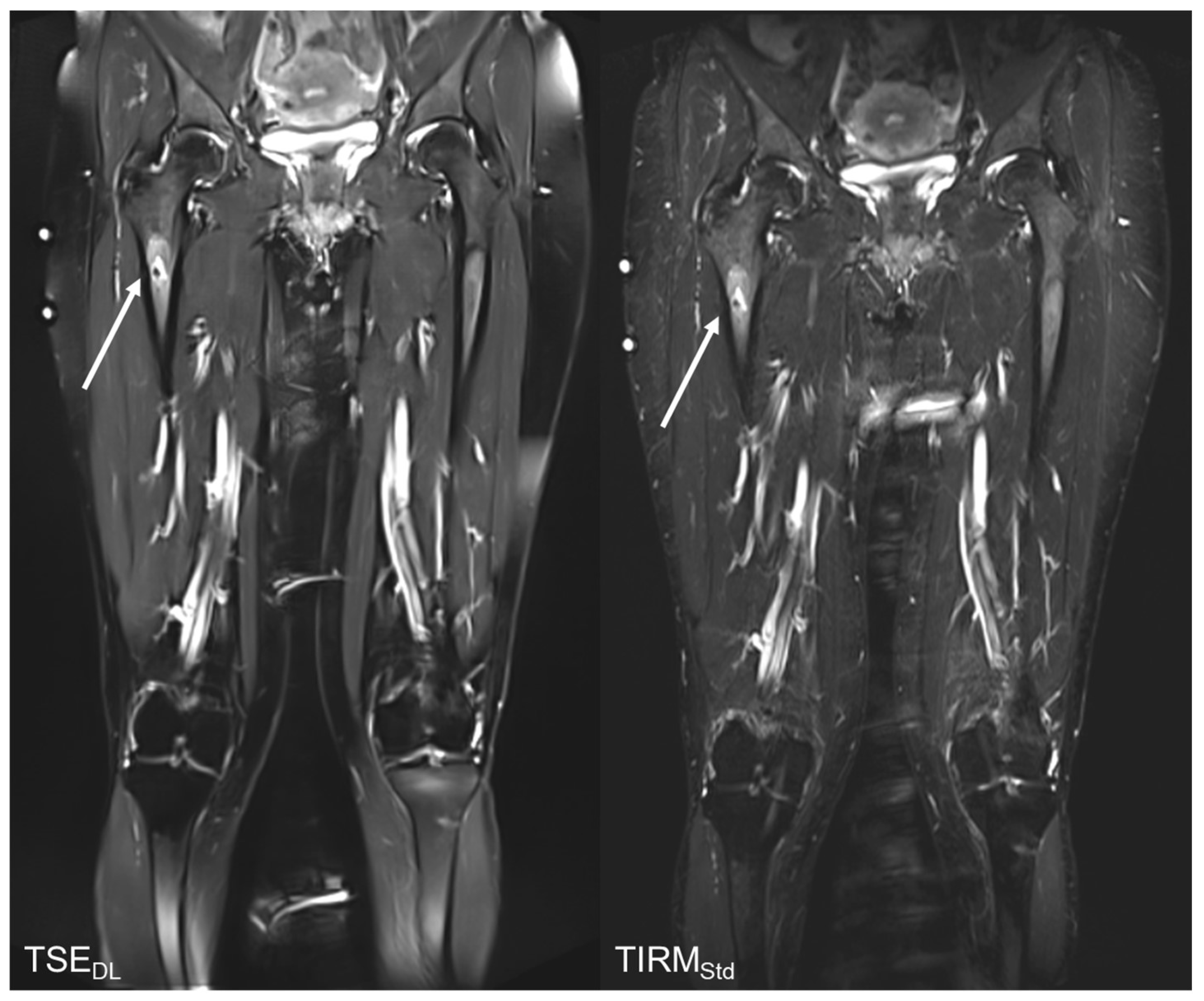 Tomography 08 00148 g003