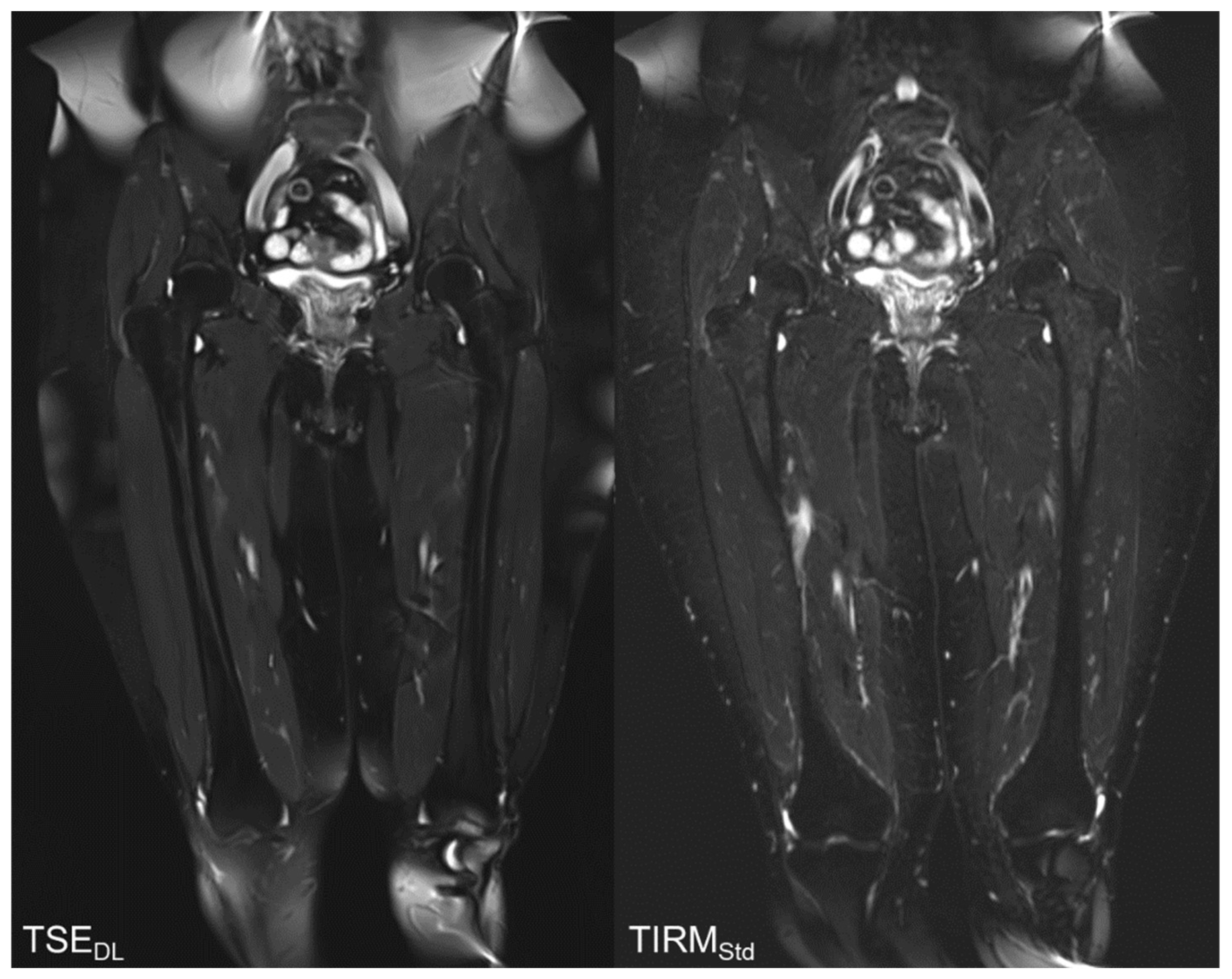 Tomography 08 00148 g004