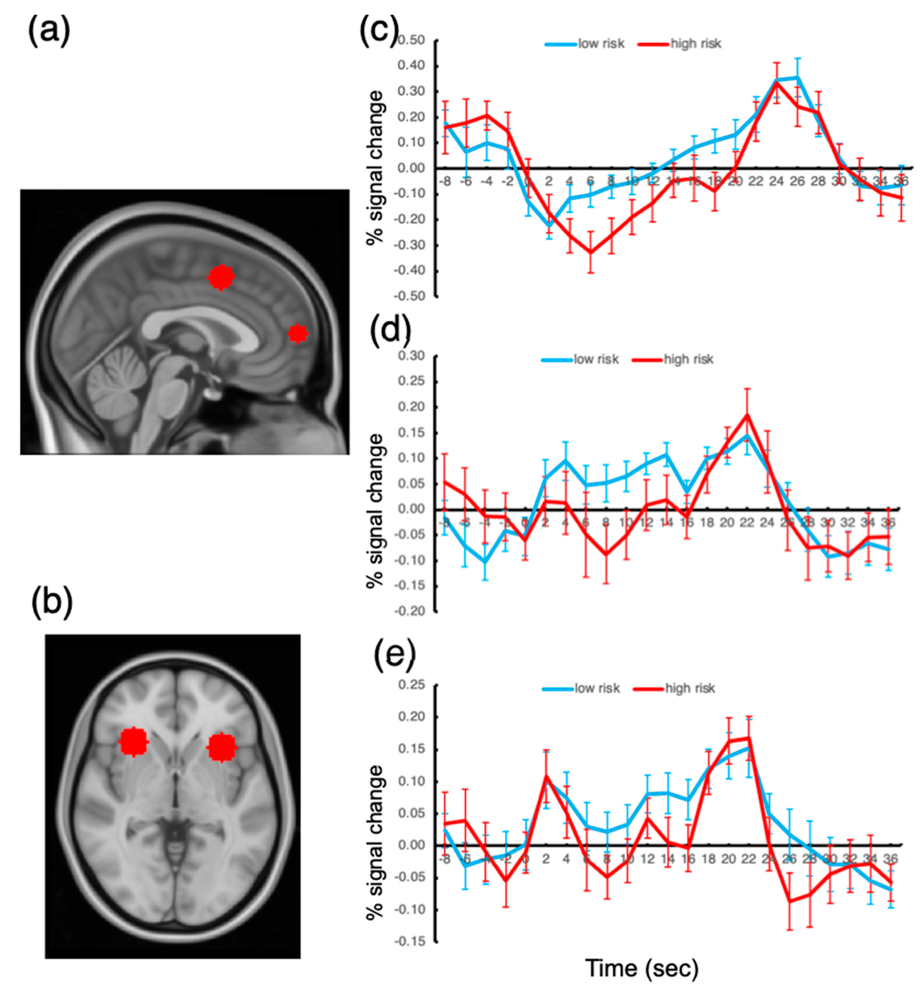 Tomography 08 00150 g004 550