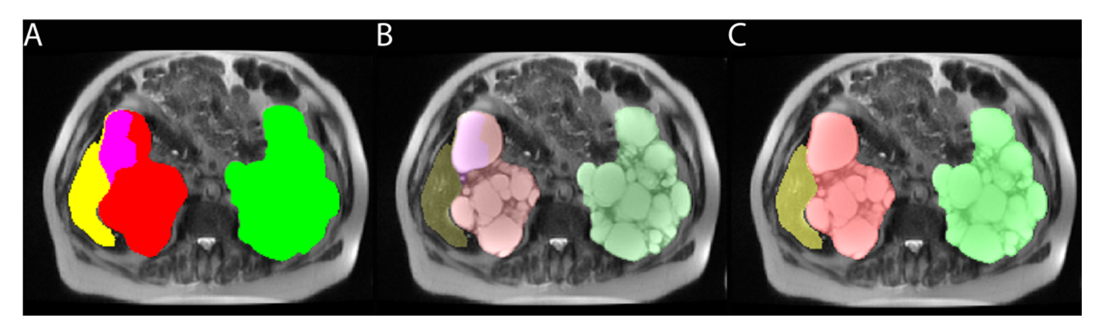 Tomography 08 00152 g002