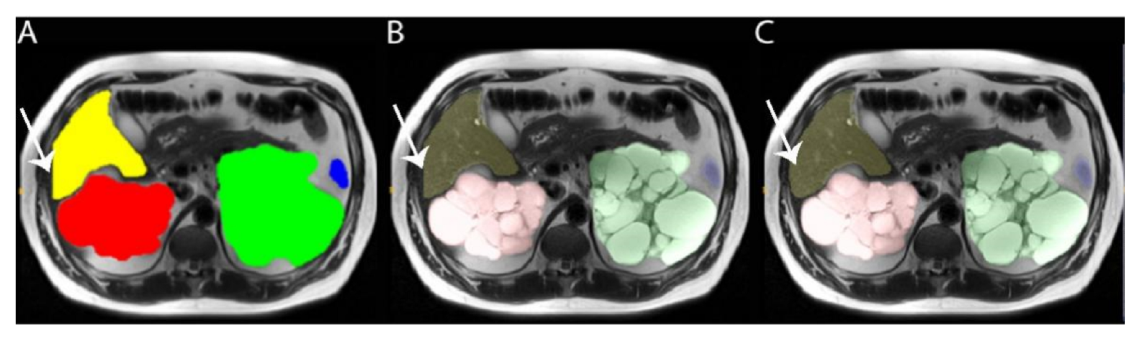 Tomography 08 00152 g003
