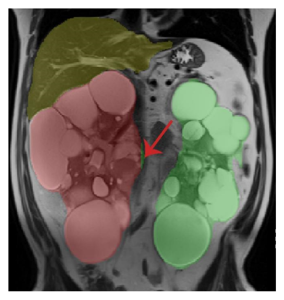 Tomography 08 00152 g007