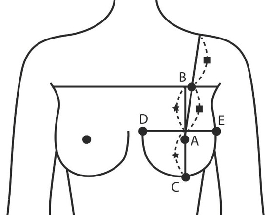 Tomography, Free Full-Text