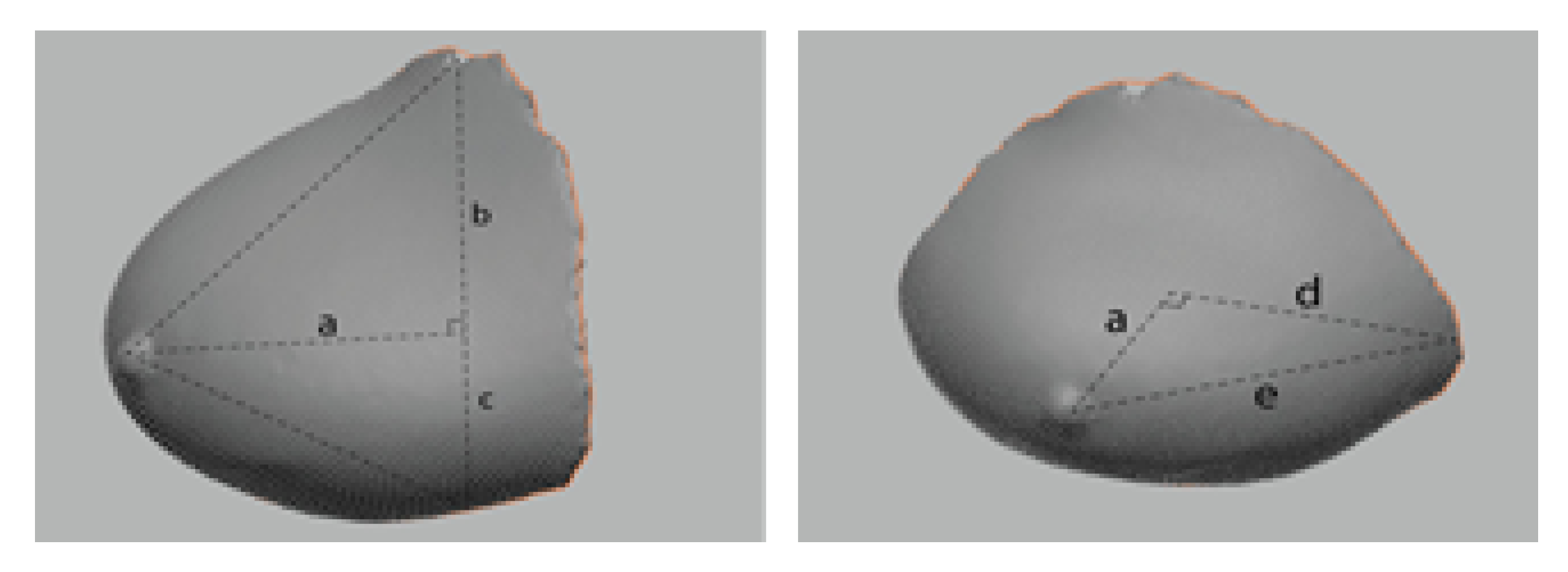 Tomography 08 00153 g006