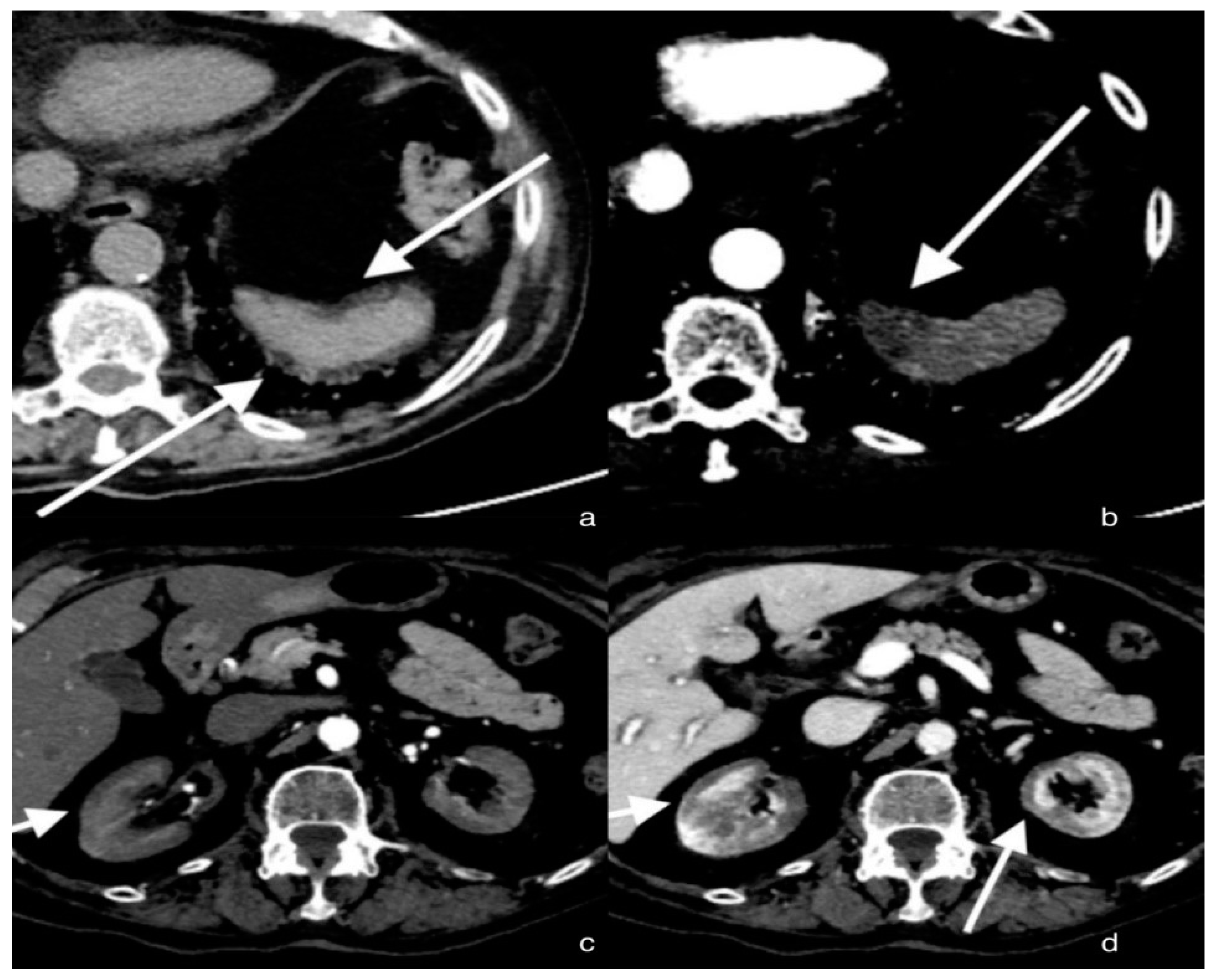 Tomography 08 00154 g001