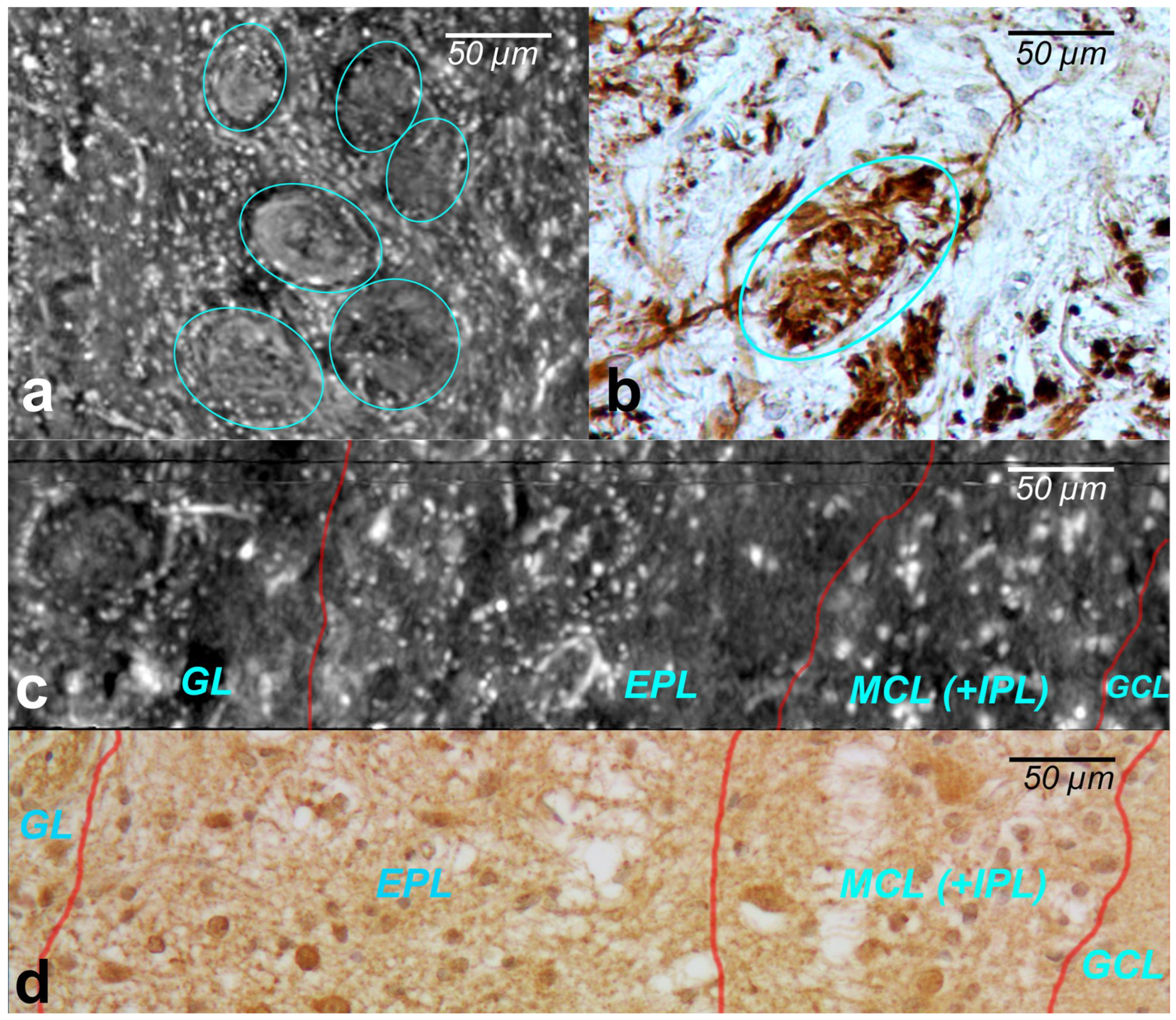 Tomography 08 00156 g003 550
