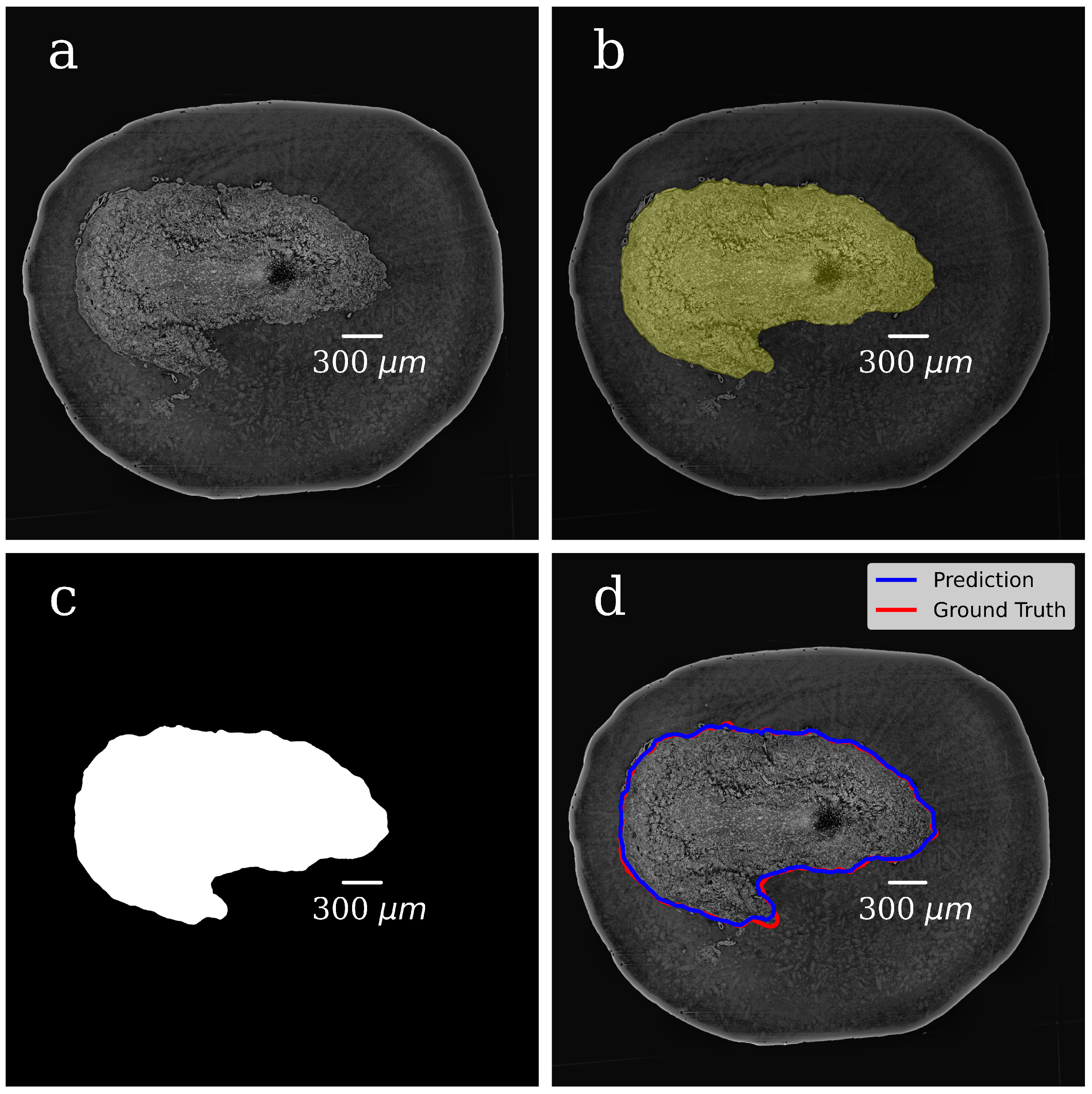 Tomography 08 00156 g004 550