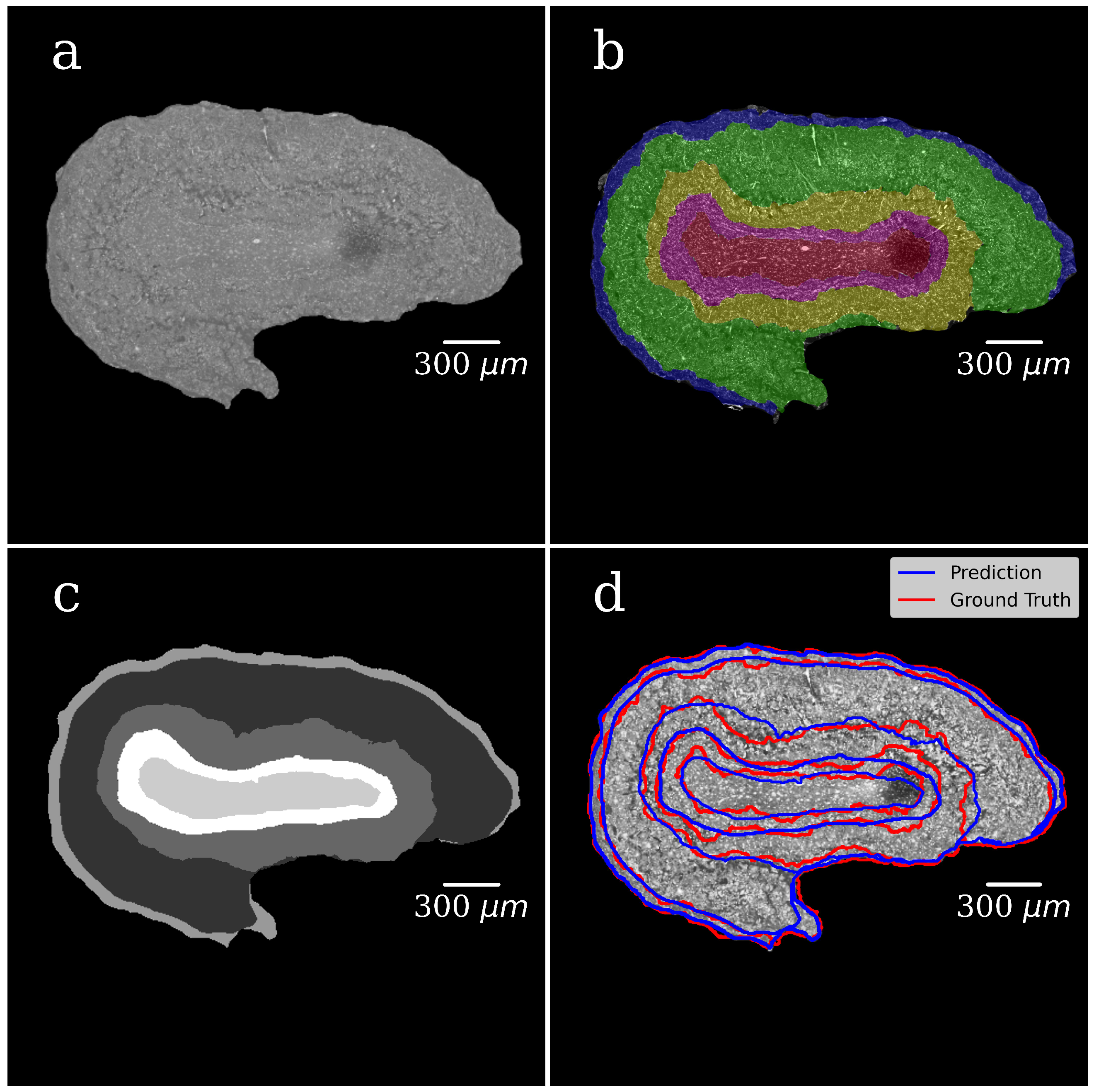 Tomography 08 00156 g005 550