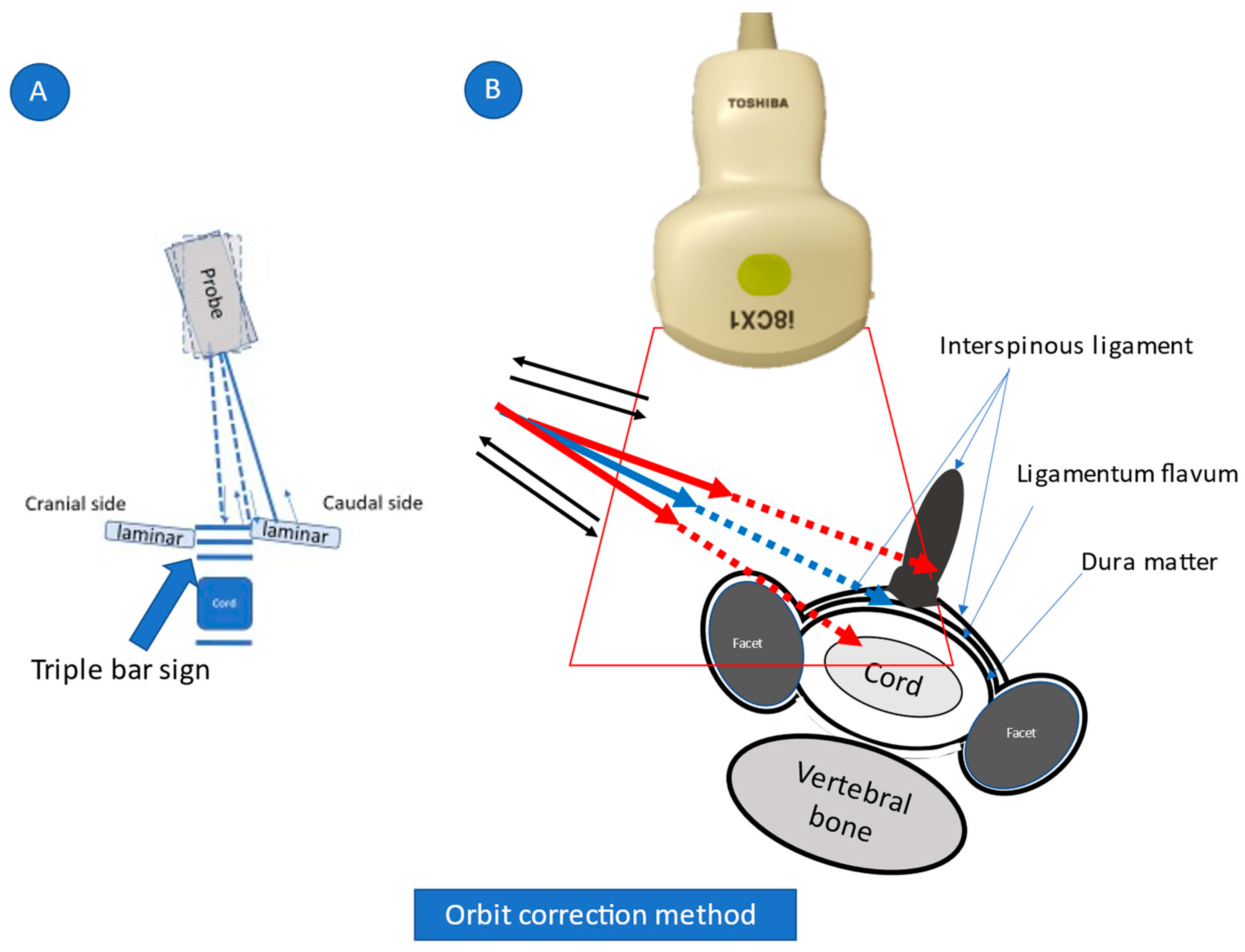 Tomography 08 00157 g003