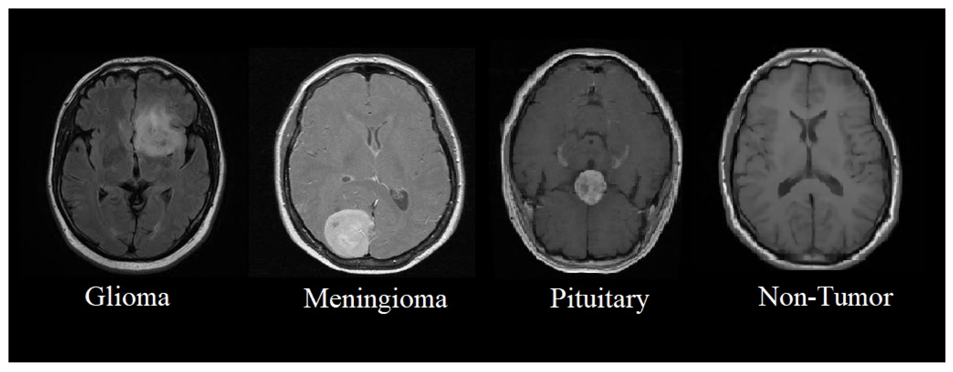 Tomography 08 00161 g001 550