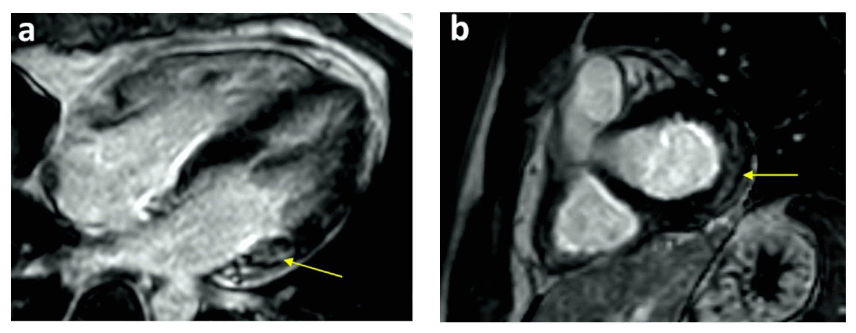 Tomography 08 00164 g002