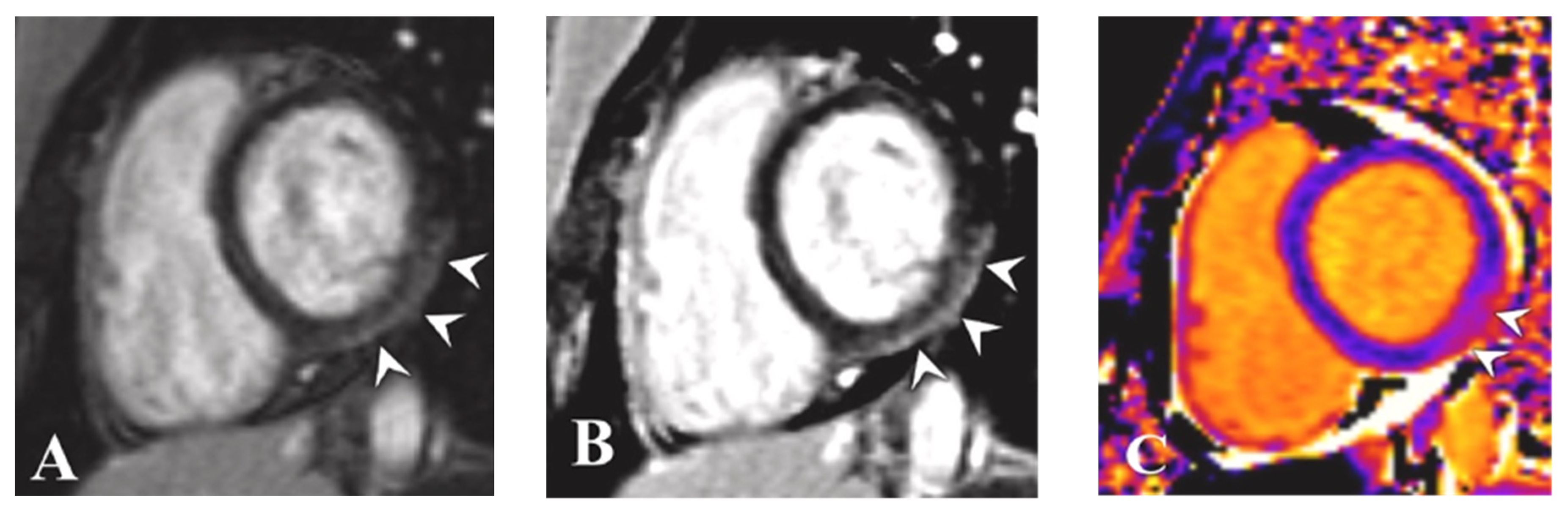 Tomography 08 00164 g004a