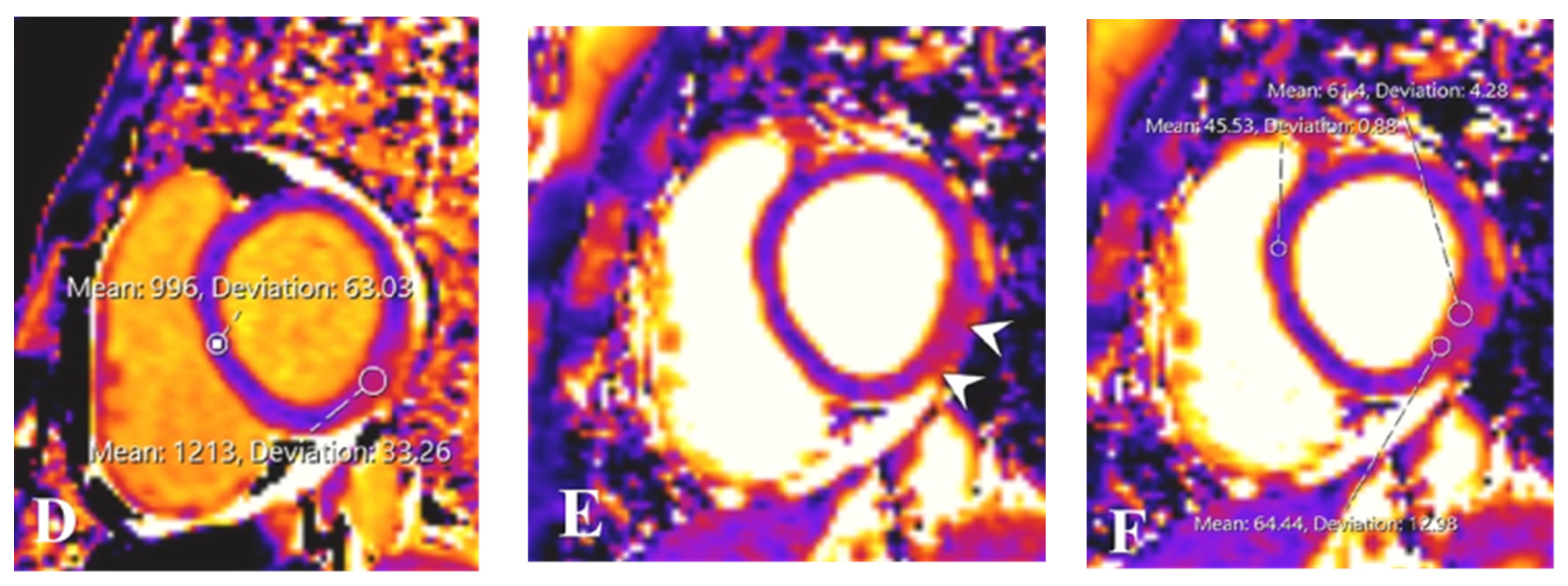 Tomography 08 00164 g004b