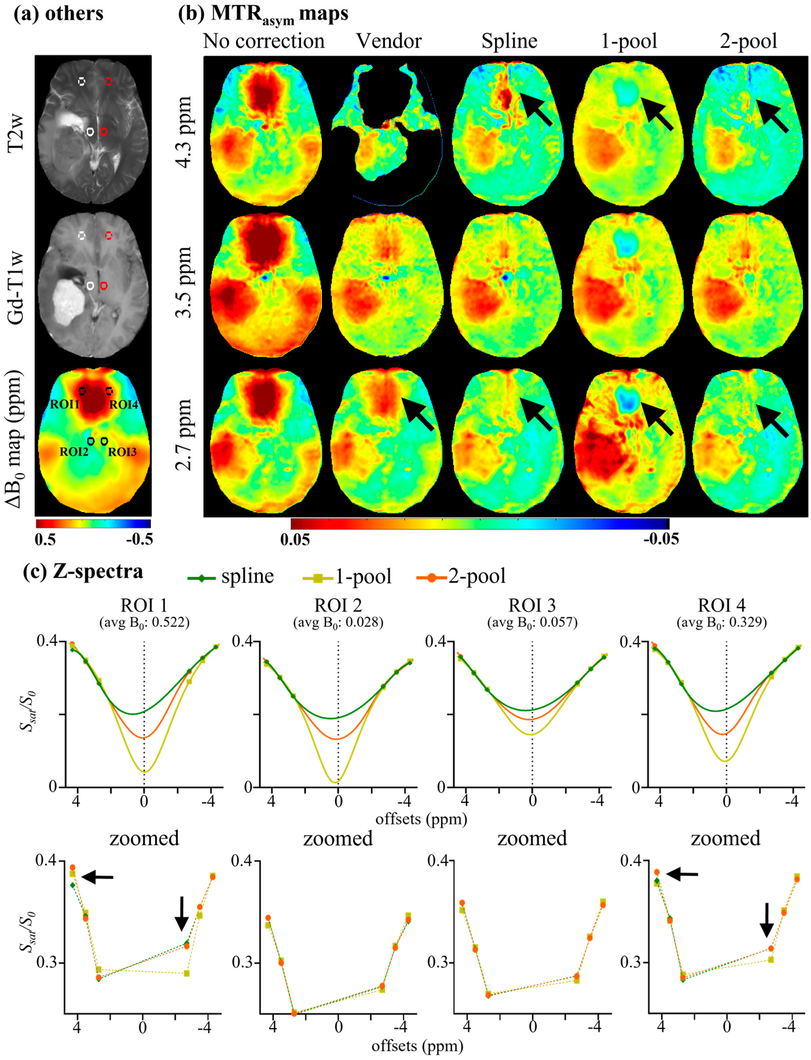 Tomography 08 00165 g005 550
